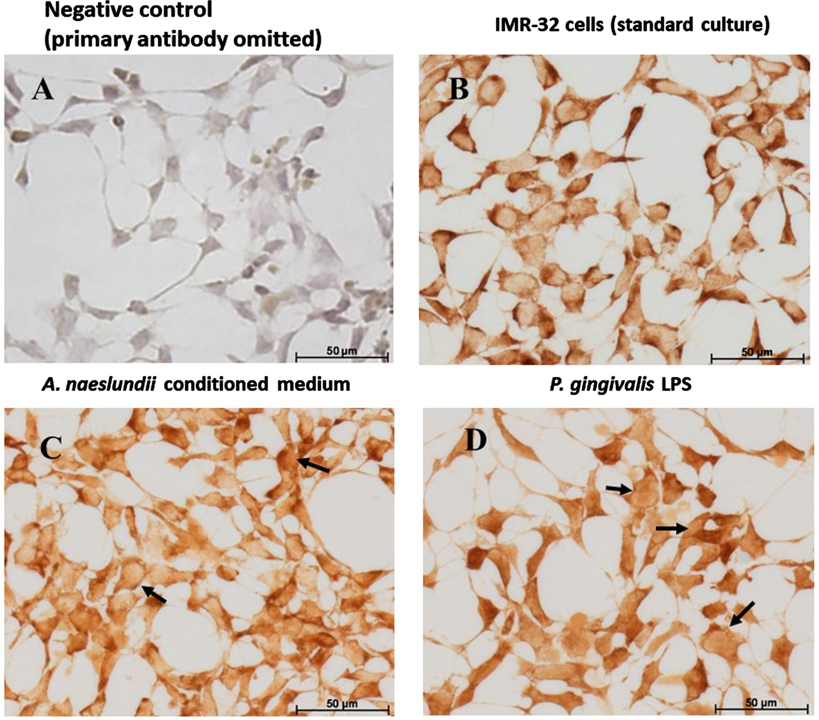 IMR 32 cells: GSK-3β Immunohistochemistry. GSK-3β immunostaining of IMR-32 cells: Comparing with the negative control (A), GSK-3β is expressed by IMR-32 cells under control and all treatment conditions. Under standard culture conditions (B), IMR-32 showed strong cytoplasmic localization of GSK-3β. A. naeslundii virulence factors demonstrated strong GSK-3β immunostaining in the cytoplasm (C) with a hint of nuclear staining in some cells (C arrows). Cells treated with Pg.LPS (D) predominantly demonstrated nuclear staining (D, arrows) and weaker cytoplasmic staining.
