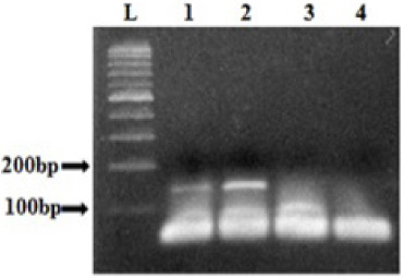 Analysis of exon 9 amplicons obtained by COLD-PCR. L: 100 bp ladder, Lanes 1, 2, and 3 correspond to the COLD-PCR results performed with 20 ng, 10 ng and 3 ng of DNA respectively. 4: negative control.