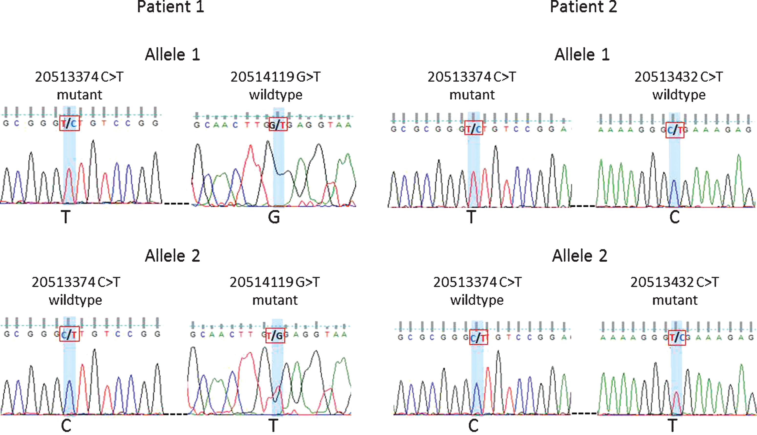 Phasing of variants 20513374 and 20514119 in Patient 1 and variants 20513374 and 20513432 in Patient 2. Sanger sequencing traces shown for patient 1: allele 1 mutant 20513374 and wildtype 20514119 vs. allele 2 wildtype 20513374 and mutant 20514119. Patient 2: allele 1 mutant 20513374 and wildtype 20513432 vs. allele 2 wildtype 20513374 and mutant 20513432.