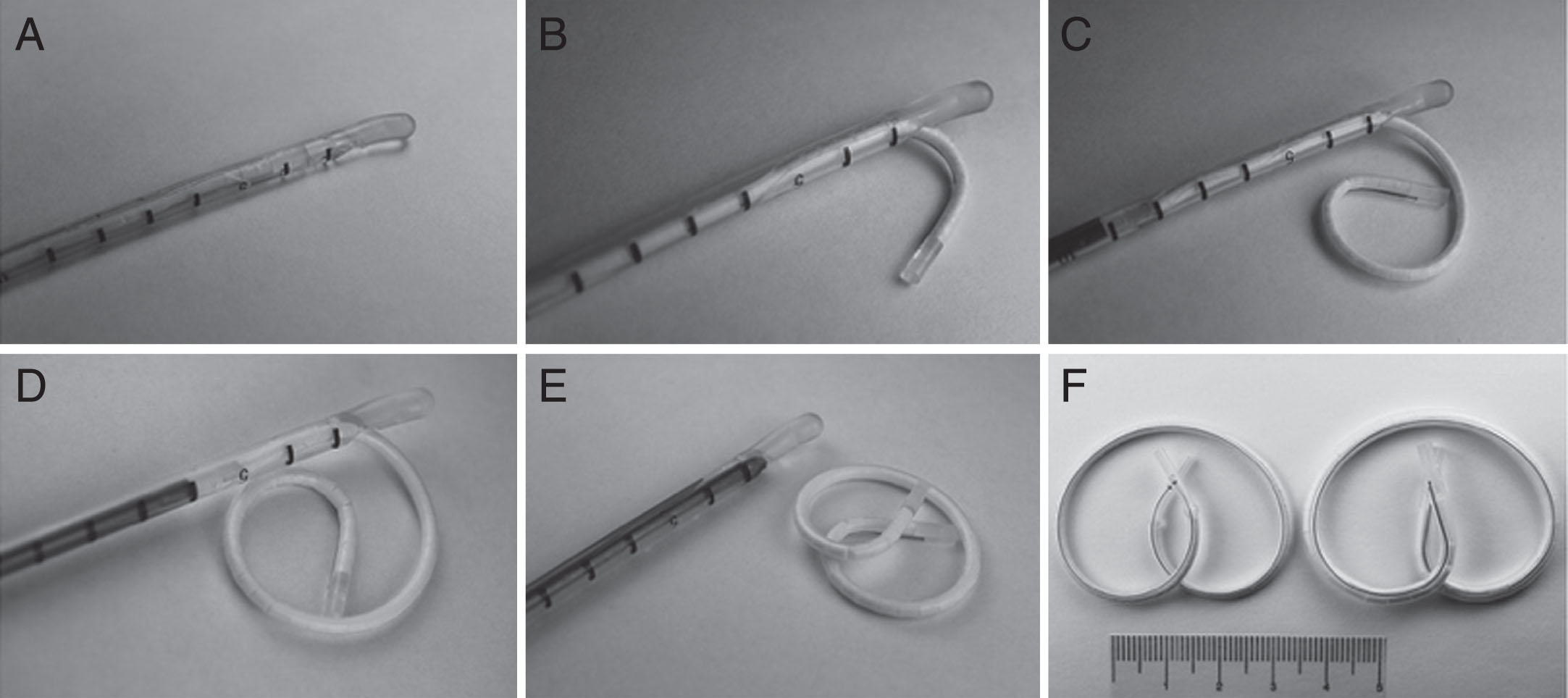 Deployment of LiRIS® through a specialized catheter as demonstrated in (A) through (E). Two devices containing different doses of the same medication are shown in (F) with a 5 cm ruler for scale. Reproduced with permission [24].