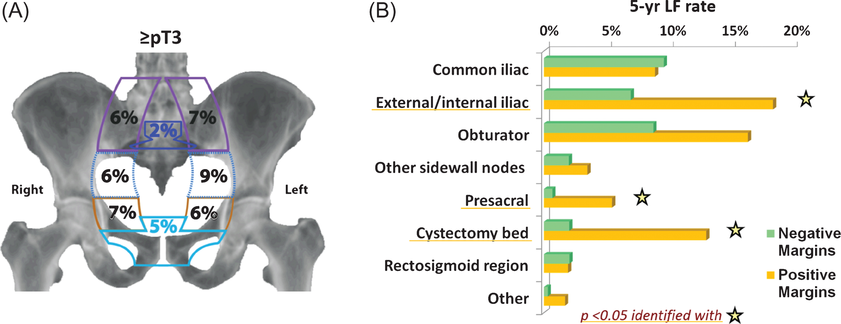 (A) Five year cumulative incidence of local-regional failure by location of recurrence for stage ≥pT3 patients. Local-regional failures were defined as recurrences in the pelvic lymph nodes or soft tissues before or within 3 months of evidence of distant failure. The pelvic sidewall nodes are the common iliac, external/internal iliac, and obturator nodes (from top to bottom). The structures in the middle of the pelvis are the presacral nodal region (superiorly) and the cystectomy bed. (B) Five year cumulative incidence of local-regional failure by site for ≥pT3 patients with positive vs. negative surgical margins.