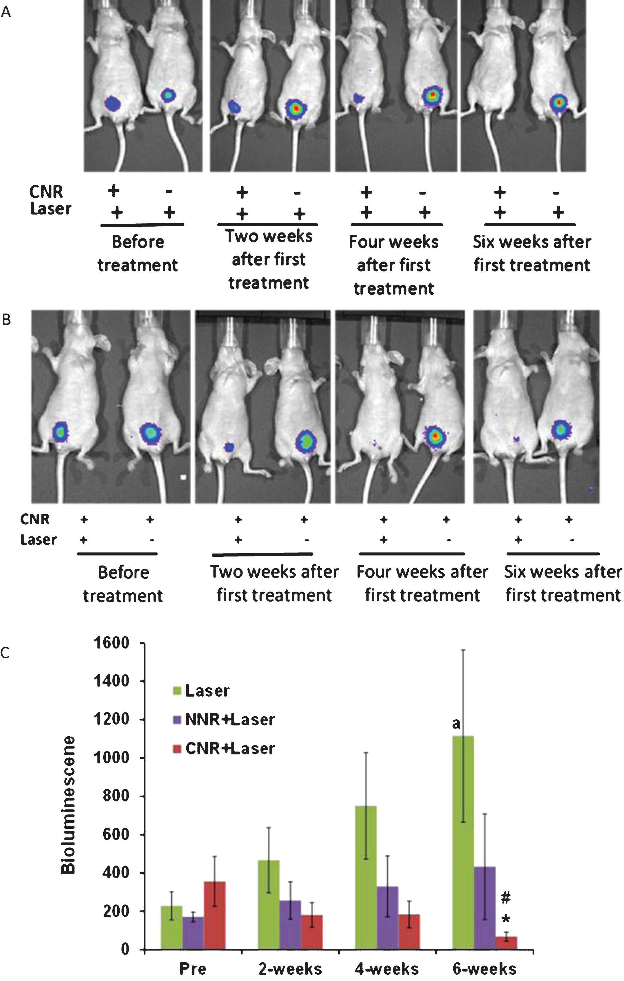 In vivo Photothermal effects of nanorods. Representative mice with positive luciferase images were intravesically treated with CNR in conjunction with external delivery of NIR light once per week for four weeks, using the optimized safe dose of laser treatment (power density of 2.1 W/cm2 for 30 seconds). The presence of viable tumor cells was tracked by bioluminescent imaging weekly for at least six weeks. Representative images show significant anti-tumor effect of CNR followed by NIR laser as compared with the negative controls with and without CNR followed by laser treatment (Fig. 4A) and CNR treatment with and without laser (Fig. 4B). Figure 4C shows the effects of treatments on tumor growth by luminescence units. *p = 0.035 effect of CNR+Laser treatment compared to laser treatment alone at 6 weeks. #p≤0.04 and ap = 0.046 compared to pre-treatment. NNR = naked nanorods, CNR = conjugated nanorods.