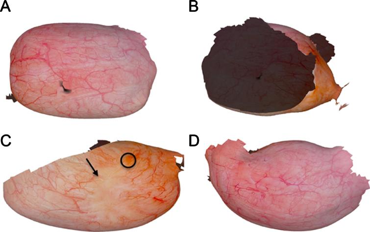 Reconstruction from a clinical dataset of human bladder. Cystoscopy image reconstruction views from the (A) anterior, (B) posterior, (C) left lateral, and (D) right lateral walls. Black circle and arrow in (C) show regions of a papillary tumor and scarring, respectively. Regions that appear dark represent the interior of the bladder. From [59] with permission.