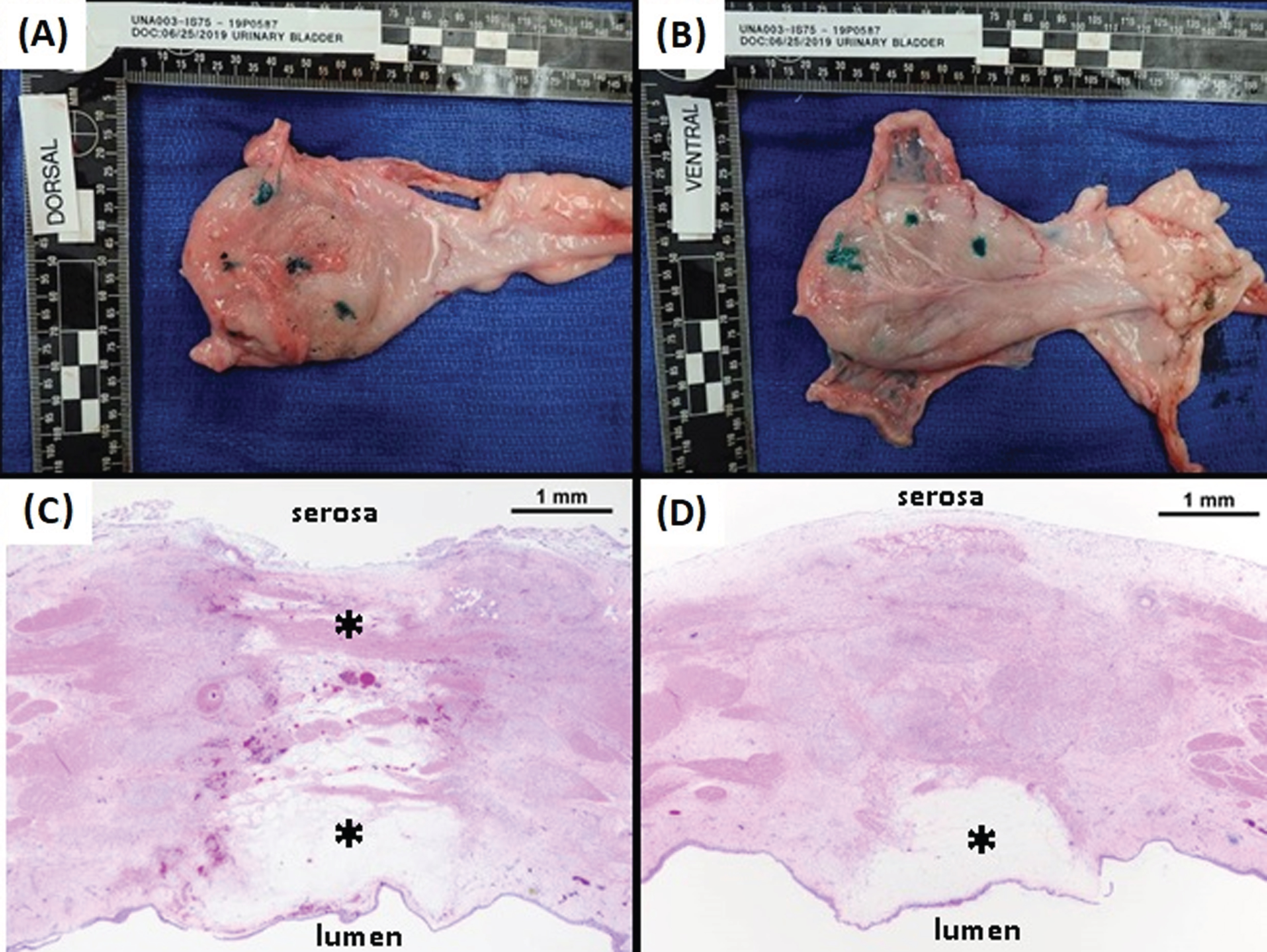 Gross Pathology and Histology of a Resected Bladder. At 7 days following the in vivo procedures bladders were resected and fixed. Gross pathology of the dorsal (A) and ventral (B) serosal surfaces of a bladder revealed numerous transmural lesions (inked sites). Histology (H & E staining) of two representative ablation sites show clearly defined lesions with visible edema and tissue disruption. Lesion depth was contingent on the freeze duration with a 60 sec freeze (C) resulting in ablation of the full thickness of the bladder wall and a 15 sec freeze (D) resulting in an ablative zone confined to the sub-mucosa.
