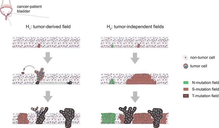 Hypothetical scenarios for the evolution of field changes in the bladder urothelium. Left: tumors develop from clones following the occasional mutation of cancer-driver genes and mutant fields extend as a consequence of tumor cell seeding (e.g. by shedding and implantation in distal regions or through horizontal trans-urothelial migration), preserving a clonal relationship with the tumor of origin. Right: mutant fields arise as a consequence of the accumulation of mutations in non-neoplastic proliferative cells and subsequent somatic clonal expansions. Cancer-driver mutations can occur within pre-established fields and cause tumors to arise as subclones of these, while other contemporary fields develop devoid of tumors and keep mutations not found in the tumors. This latter scenario is supported by N-mutations found in Strandgaard et al’s work, while we cannot discard a combination of the two models.