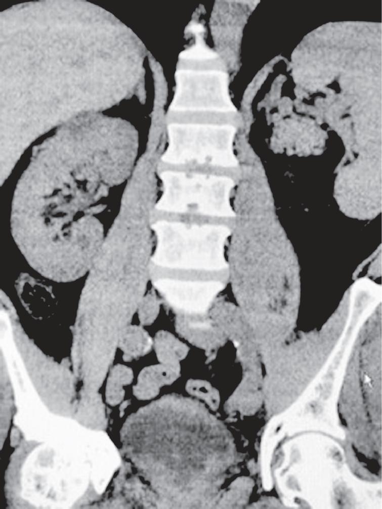 Imaging of the abdomen and pelvis.
