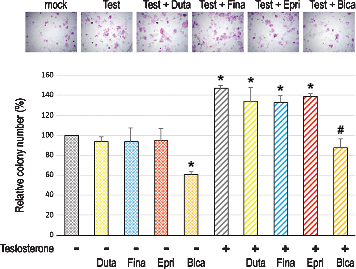 Effects of 5α-RIs on neoplastic transformation of urothelial cells determined by colony-forming ability. Clonogenic assay in SVHUC-AR cells exposed to MCA, subcultured for 6 weeks in medium containing 5% FBS as well as ethanol (mock), dutasteride (Duta; 100 nM), finasteride (Fina; 500 nM), epristeride (Epri; 5μM), bicalutamide (Bica; 5μM), and/or testosterone (Test; 10 nM), and further incubated for 2 weeks without 5α-RI/testosterone treatment. The number of colony consisting of ≥20 cells is presented relative to that of mock-treated cells. Each value represents the mean (+SD) from three independent experiments. *P < 0.05 (vs. mock treatment). #P < 0.05 (vs. testosterone treatment).