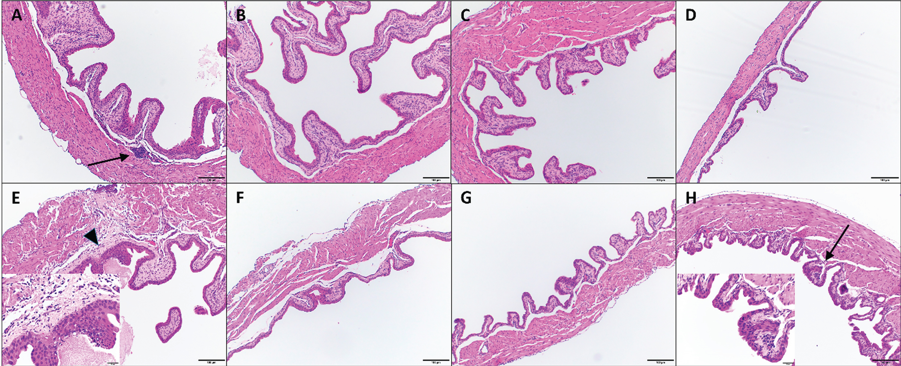Histologic images of mouse urinary bladders at different time points. Images A-D. IL-12 alone treatment at 24h (A), 48 hours (B), 72 hours (C) and 96 hours (D). Images E-H. CS/IL-12 treatment at 24h (E), 48 hours (F), 72 hours (G) and 96 hours (H). Arrows indicate minimal lymphoplasmacytic perivascular infiltrates that constituted a grade 1 response; insert for image (H) shows inflammation at higher magnification. Arrowhead indicates rare, minimal neutrophilic inflammation and fibrin exudation (also grade 1); insert for image (E) shows inflammation at higher magnification. All images using 10x objective. Inserts for (E) and (H) are using 40x objective.