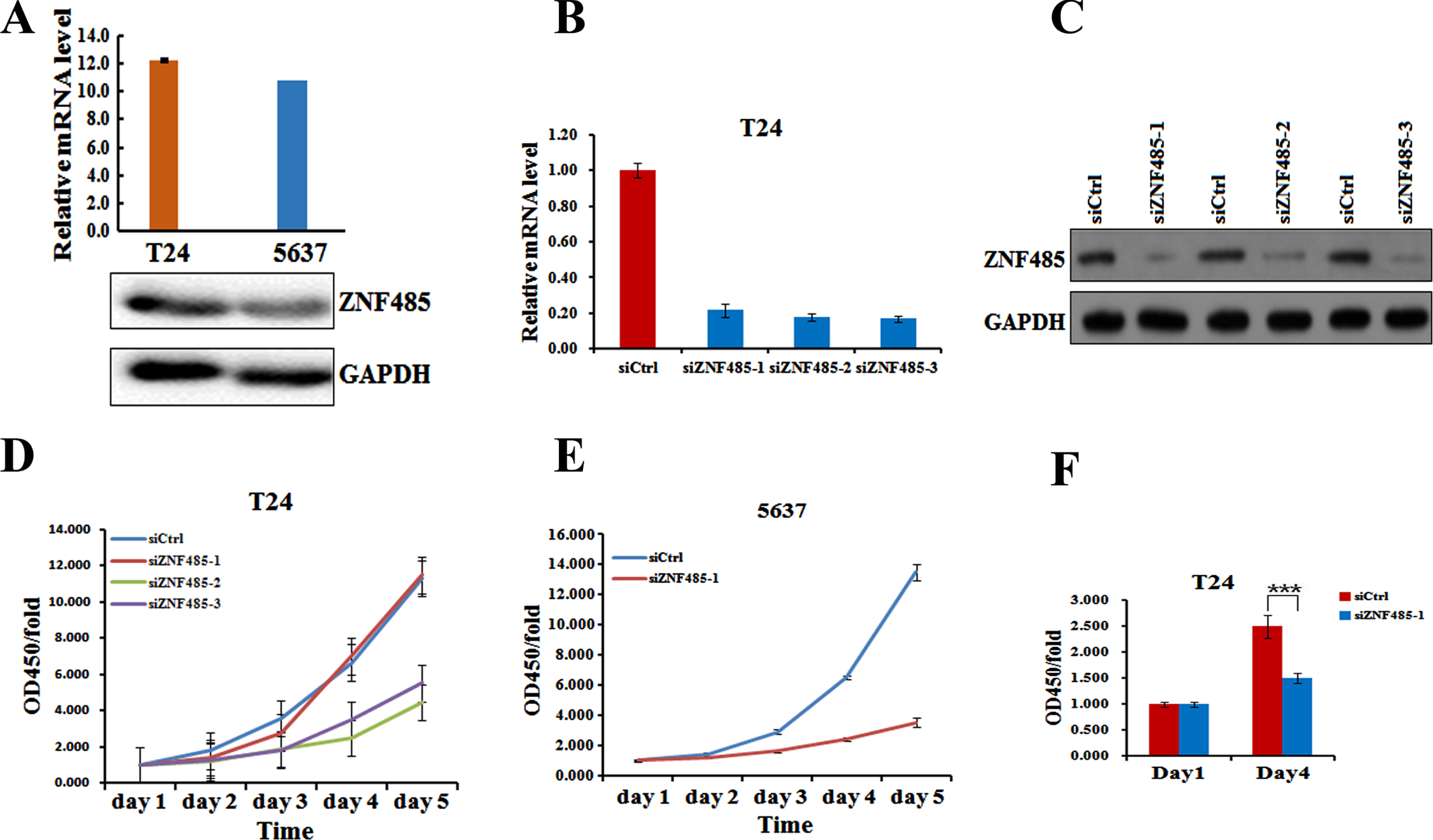 Knockdown of ZNF485 inhibits BLCA cell proliferation. (A) Levels of ZNF485 in BLCA 5637 and T24 cells measured by real-time PCR and western blot analyses. (B and C) The mRNA and protein levels of ZNF485 determined by (B) real-time PCR and (C) western blot analyses in three different regions of siRNAs transfected into T24 cells versus the negative control (siCtrl). (D) CCK-8 assays every 24 hours showed that ZNF485 inhibited the proliferation of T24 cells transfected with three different regions of siRNAs versus the negative control (siCtrl). (E) CCK-8 assays every 24 hours showed that ZNF485 inhibited the proliferation of 5637 cells transfected with ZNF485knockdown versus the negative control (siCtrl). (F) ZNF485 inhibited cell proliferation, as shown by EdU staining assays, in T24 cells transfected with ZNF485 knockdown versus the negative control (siCtrl). ***, p value < 0.001.