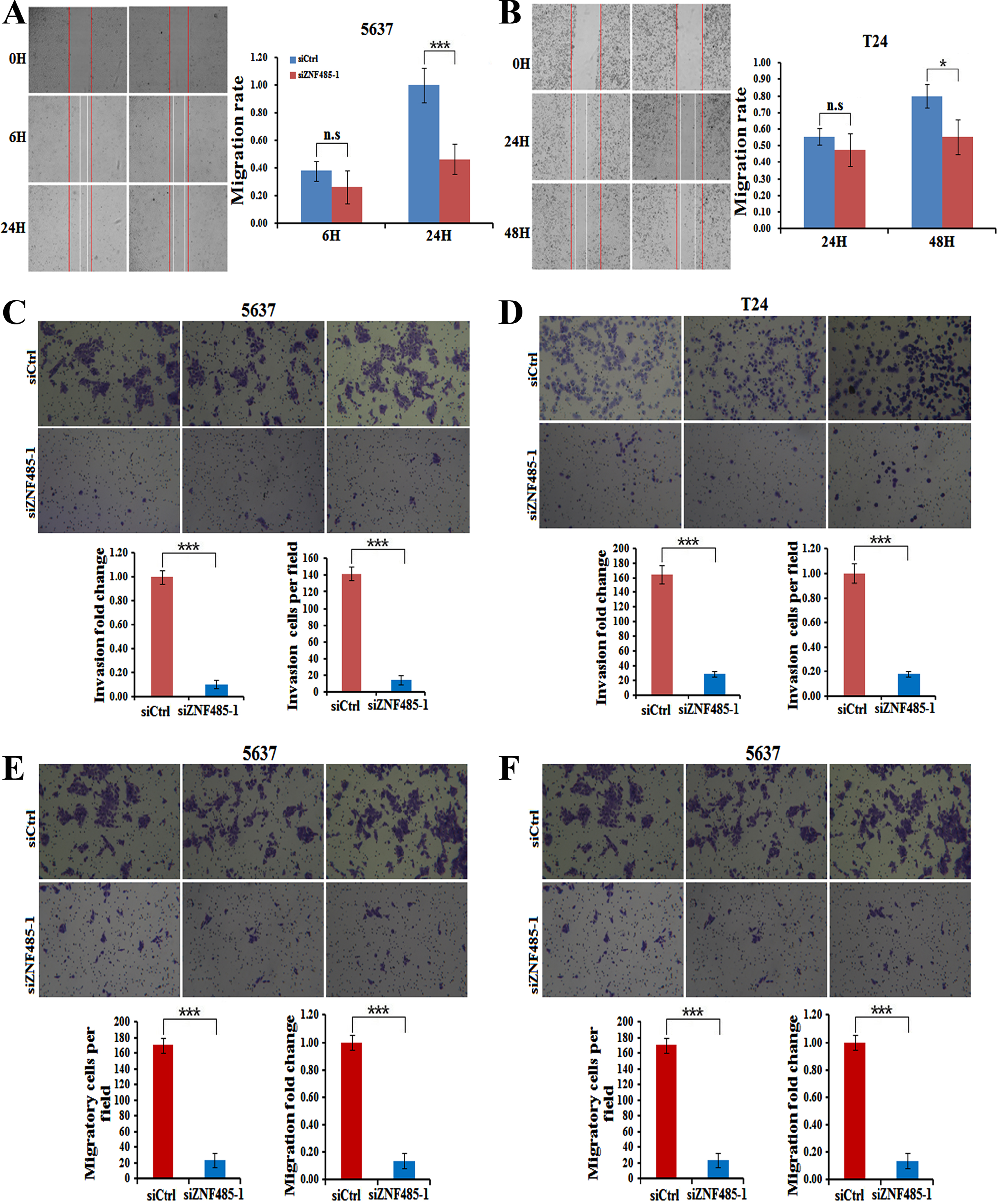 ZNF485 knockdown inhibits BLCA cell wound healing and invasion. (A) The wound healing assays showed that ZNF485 knockdown reduced the cell mobility of 5637 cells versus the negative control (siCtrl) for 48 hours, and the results were recorded (left) and quantitatively analyzed (right). ***, p value < 0.001. (B) The wound healing assays showed that ZNF485 knockdown reduced the cell mobility of T24 cells versus the negative control (siCtrl) for 48 hours (left) and quantitatively analyzed (right). *, p value < 0.05. (C) Representative images (left) and quantification (right) of invasion assays showed that ZNF485 knockdown reduced the invasion of 5637 cells versus the negative control (siCtrl) at 36 hours. *, p value < 0.05. Scale bar: 100μm. (D) Representative images (left) and quantification (right) of invasion assays showed that ZNF485 knockdown reduced the invasion of T24 cells versus the negative control (siCtrl) at 36 hours. *, p value < 0.05. Scale bar: 100μm. (E) Representative images (left) and quantification (right) of migration assays showed that ZNF485 knockdown reduced the migration of 5637 cells versus the negative control (siCtrl) for 36 hours. *, p value < 0.05. Scale bar: 100μm. (F) Representative images (left) and quantification (right) of migration assays showed that ZNF485 knockdown reduced the migration of T24 cells versus the negative control (siCtrl) for 36 hours. *, p value < 0.05. Scale bar: 100μm.