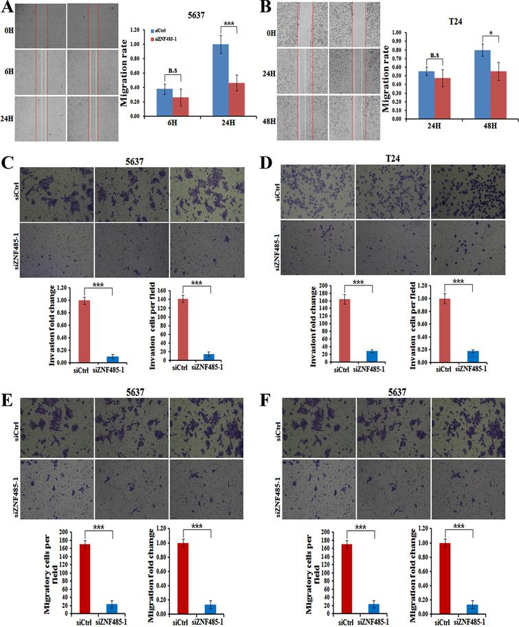 ZNF485 knockdown inhibits BLCA cell wound healing and invasion. (A) The wound healing assays showed that ZNF485 knockdown reduced the cell mobility of 5637 cells versus the negative control (siCtrl) for 48 hours, and the results were recorded (left) and quantitatively analyzed (right). ***, p value < 0.001. (B) The wound healing assays showed that ZNF485 knockdown reduced the cell mobility of T24 cells versus the negative control (siCtrl) for 48 hours (left) and quantitatively analyzed (right). *, p value < 0.05. (C) Representative images (left) and quantification (right) of invasion assays showed that ZNF485 knockdown reduced the invasion of 5637 cells versus the negative control (siCtrl) at 36 hours. *, p value < 0.05. Scale bar: 100μm. (D) Representative images (left) and quantification (right) of invasion assays showed that ZNF485 knockdown reduced the invasion of T24 cells versus the negative control (siCtrl) at 36 hours. *, p value < 0.05. Scale bar: 100μm. (E) Representative images (left) and quantification (right) of migration assays showed that ZNF485 knockdown reduced the migration of 5637 cells versus the negative control (siCtrl) for 36 hours. *, p value < 0.05. Scale bar: 100μm. (F) Representative images (left) and quantification (right) of migration assays showed that ZNF485 knockdown reduced the migration of T24 cells versus the negative control (siCtrl) for 36 hours. *, p value < 0.05. Scale bar: 100μm.