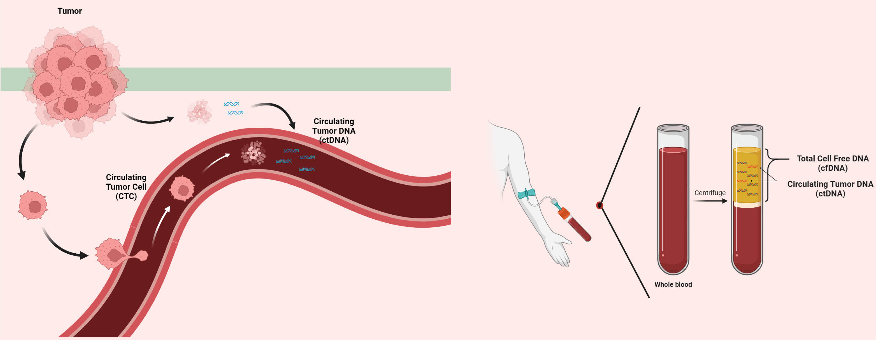 Circulating Tumor DNA.