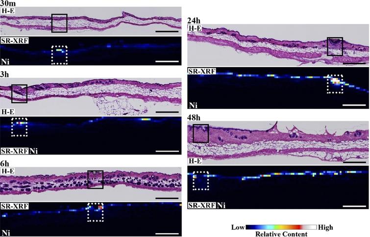 Histopathological (H–E stained) and elemental distribution images, as obtained by SR-XRF, of mouse skin following Ni allergy patch application for 30 min to 48 h (cross section, bar = 500 µm). (Colors are visible in the online version of the article; http://dx.doi.org/10.3233/BME-151543.)