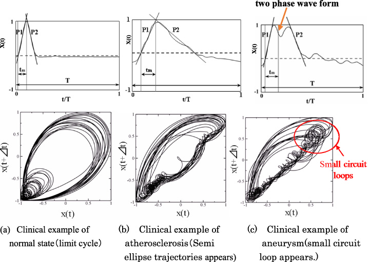 Pulsatile velocity and its attracter analysis of trajectories of blood vessel walls under pulsatile pressure conditions during systolic process. T is periodic time. t is time. Δt = 30 [ms]. X (t) is expansion velocity of blood vessel wall during systolic process.