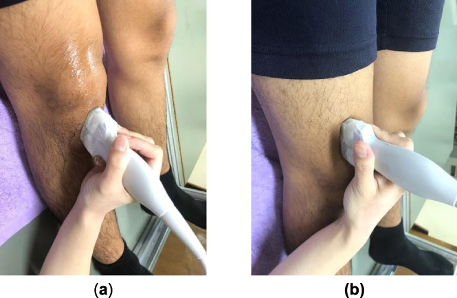 Ultrasound transducer placement for the patellar and quadriceps tendons. (a) Measurement site for the patellar tendon. (b) Measurement site for the patellar tendon.