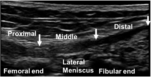 B-mode ultrasound image of the lateral collateral ligament at the 0° knee position. Arrows indicate the proximal, middle, and distal portions of the lateral collateral ligament.