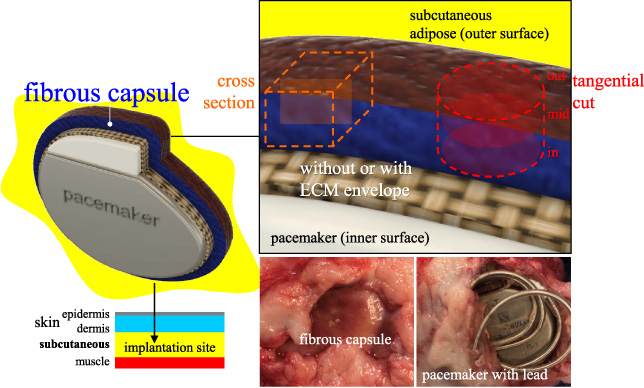 A pacemaker model (top left) implanted in the subcutaneous pocket (bottom left) with the subsequent fibrous capsule (Fb) response (bottom center). After retrieval (bottom right), select Fb with distinct inner and outer surfaces was cut into cross and tangential (in, mid, and out) sections (top right).