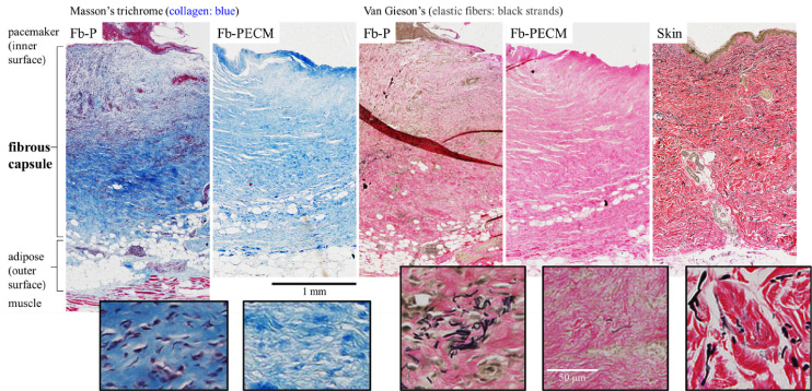 Connective tissue stains: Masson’s trichrome (MT) and Van Gieson’s (VGE) of representative Fb cross-sections with layers spanning from the implant-adjacent inner to the outer surface attached to Ad. Human skin VGE with epidermis and dermis tissues included as controls. Boxed insets demonstrate magnified regions with fibroblasts, collagen ECM (blue in MT), and elastic fibers (black strands in VGE).