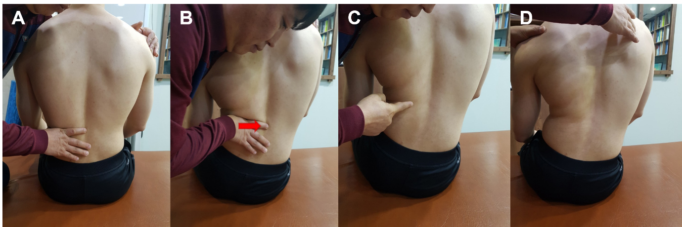 The neuromuscular stabilization technique steps. (A) manual contact, (B) correction of spinal alignment, (C) segmental stabilization, and (4) sensory-motor training.