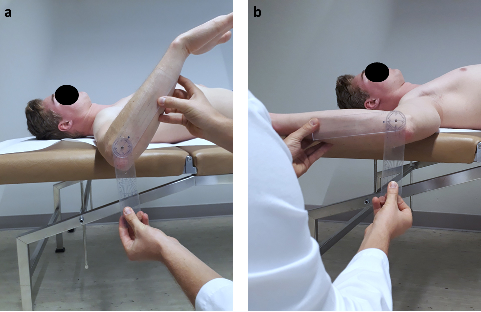 Measurement of external and internal rotation in 90∘ abduction using a goniometer with the athlete lying in supine position on a treatment table to prevent scapulothoracic movement.