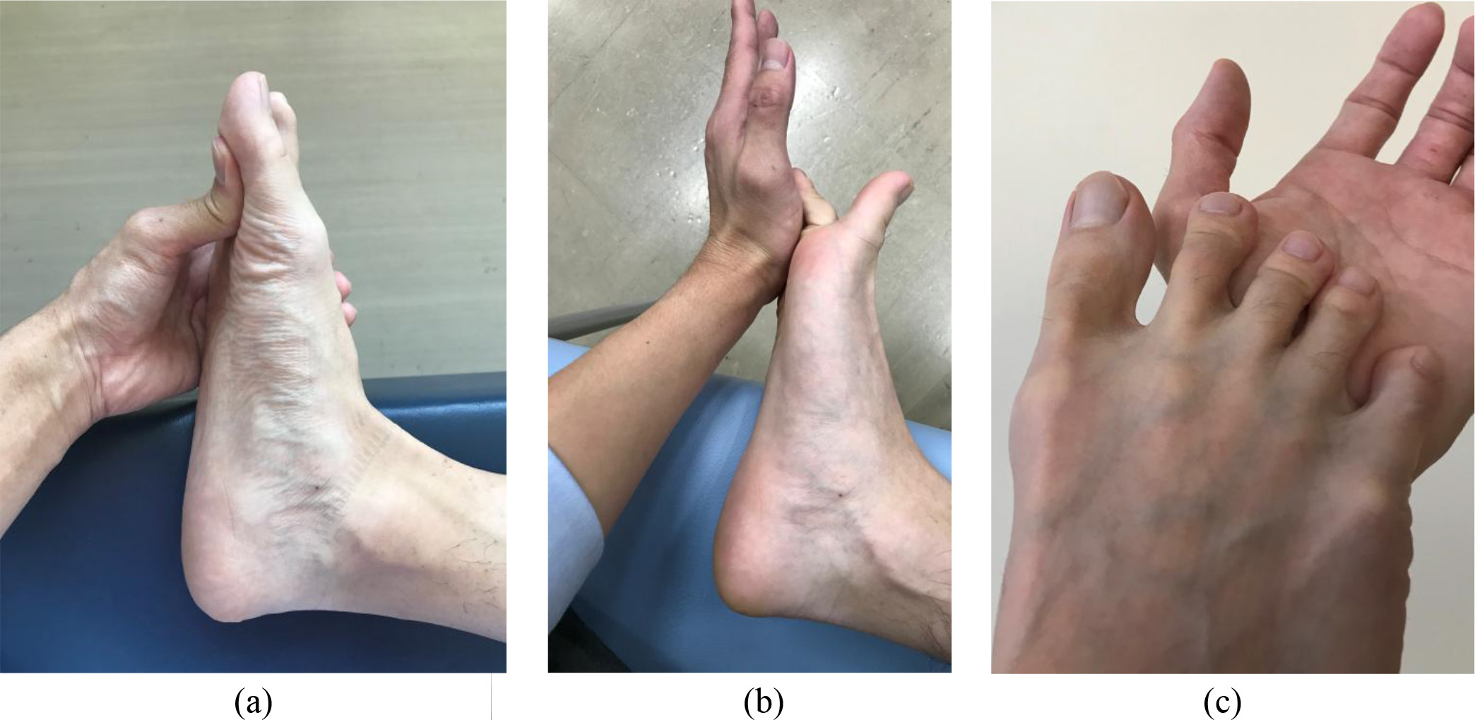 MTP flexion exercise. (a) exercise for the hallux, (b) and (c) exercise for the lesser toes. The participants were instructed to perform isometric MTP joint flexion without IP joint flexion.