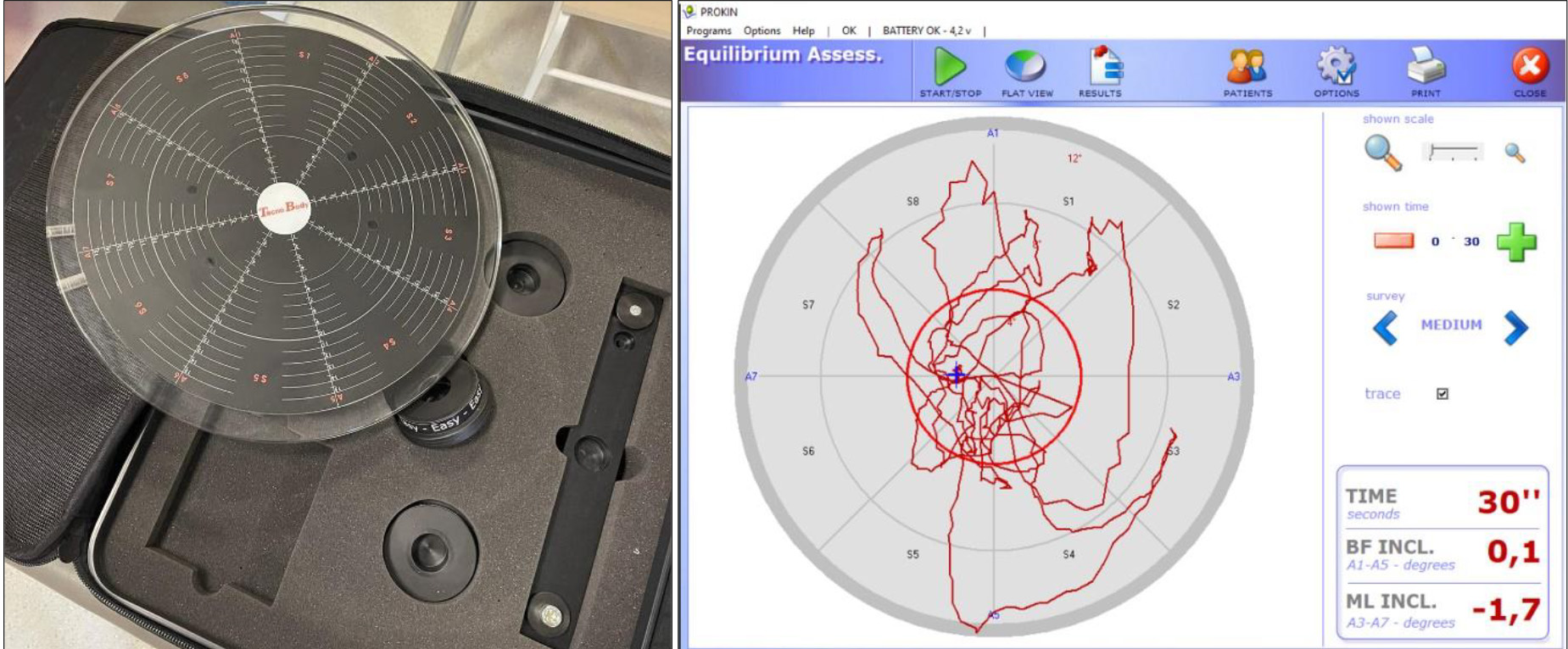 Prokin device and postural stability measurement (red circle represents reference circle).