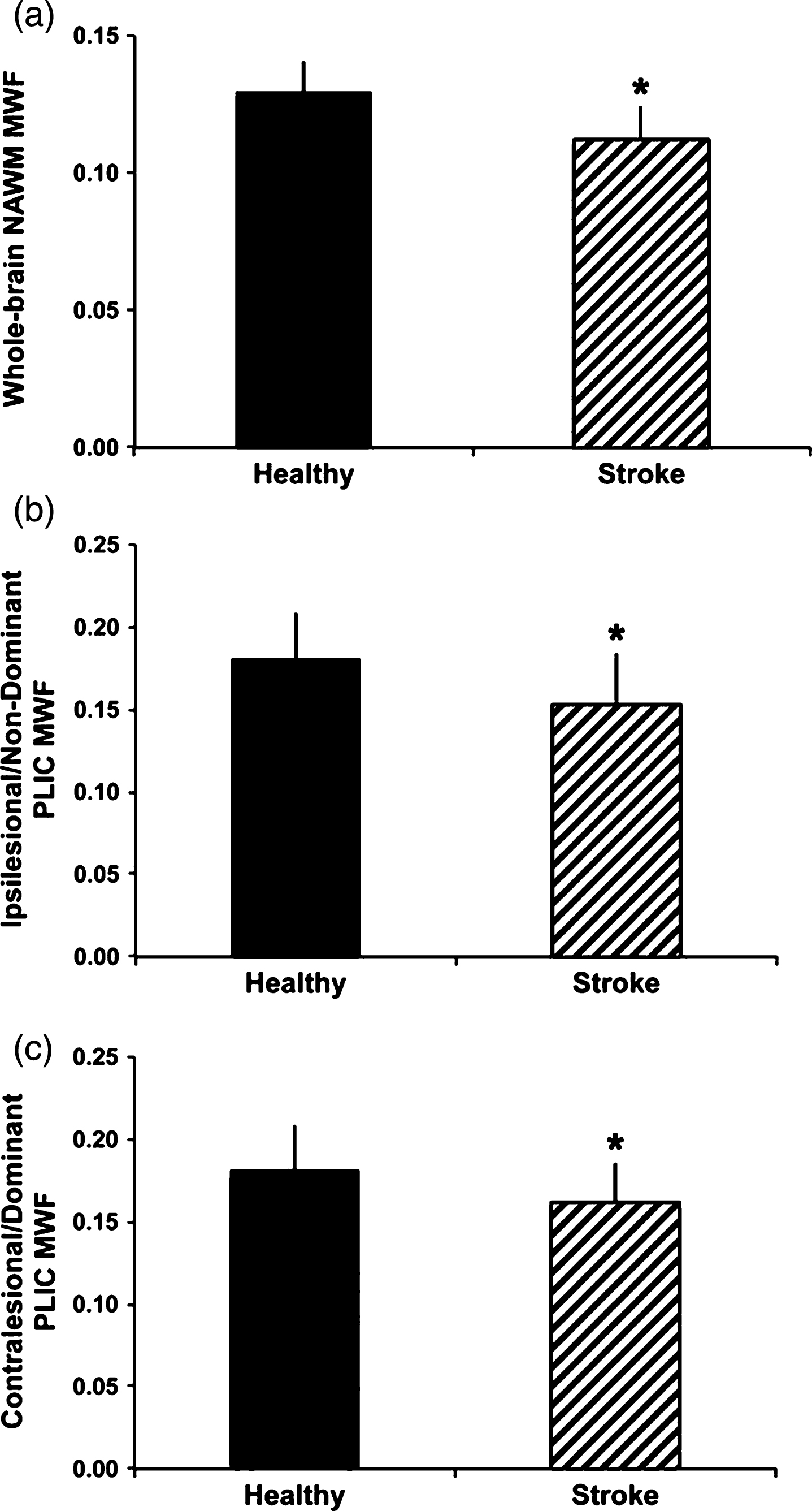 Group differences in myelin water fraction (MWF) between healthy controls and participants with chronic stroke. MWF was significantly reduced in whole-cerebrum normal appearing white matter (NAWM) in the stroke group comparedtowhole-cerebrum NAWMinthehealthy group(A),intheipsilesional posterior limb of internal capsule (PLIC) and non-dominant PLIC MWF in the healthy group (B) and in the contralesional PLIC for the stroke group versus dominant PLIC in the healthy group (C) (*p b 0.05). Error bars represent standard deviation (Fig. 5, Borich MR, Mackay AL, Vavasour IM, Rauscher A, Boyd LA. Evaluation of white matter myelin water fraction in chronic stroke. Neuroimage Clin. 2013;2:569-80).