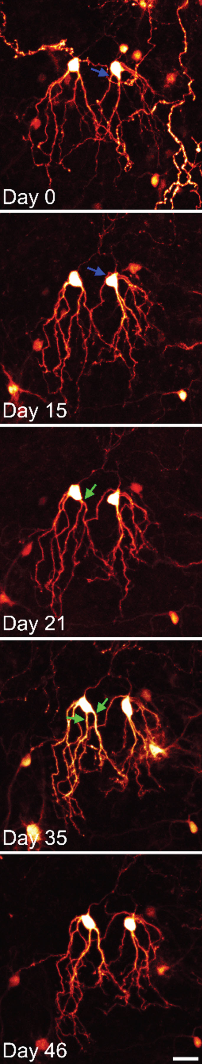Time series confocal images of YFP-expressing granule cells in an organotypic hippocampal slice culture. The two granule cells shown were imaged over a period of 6 weeks. Both cells show modest somatic translocation, with the soma moving into the apical dendrites. In both cases, this distorts the apical dendritic tree. The blue arrow shows an apical dendrite, which is shifted to the basal pole of the cell. The green arrows show the soma absorbing a dendritic branch point, converting a single primary dendrite into two primary dendrites. Scale bar = 20μm.