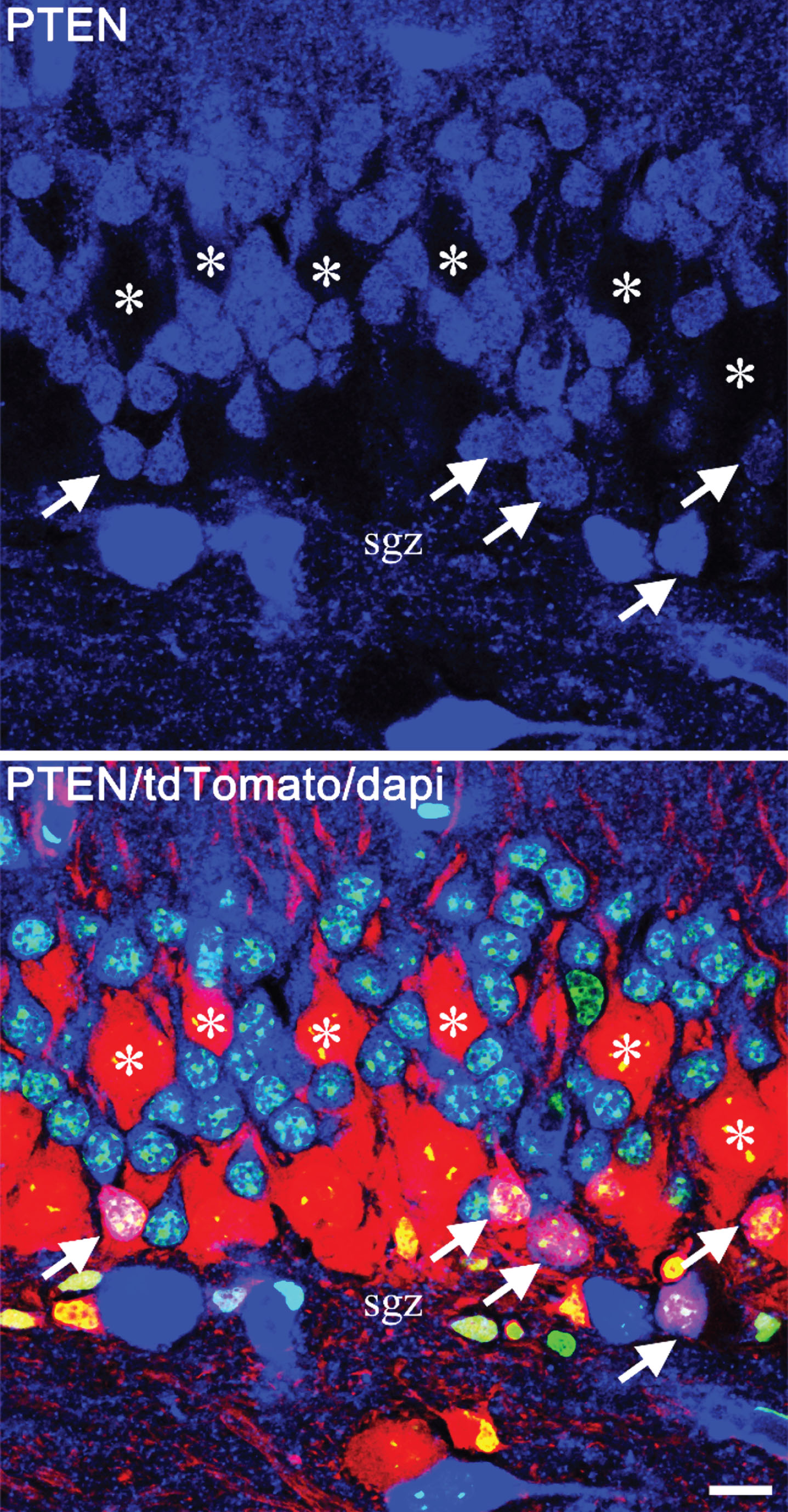 Confocal images showing mosaic deletion of PTEN from newborn hippocampal granule cells in a Gli1-CreERT2, PTENfl/fl, tdTomato reporter mouse. PTEN is shown in blue, tdTomato in red and dapi in green. The top panel shows PTEN alone, and the lower panel shows the merged image. PTEN-expressing newborn cells (arrows) are located in the inner third of the granule cell body layer, close to the subgranular zone (sgz). The much larger PTEN KO granule cells (asterisks), on the other hand, are distributed through the cell body layer, with some migrating close to the molecular layer border. Scale bar = 10μm.