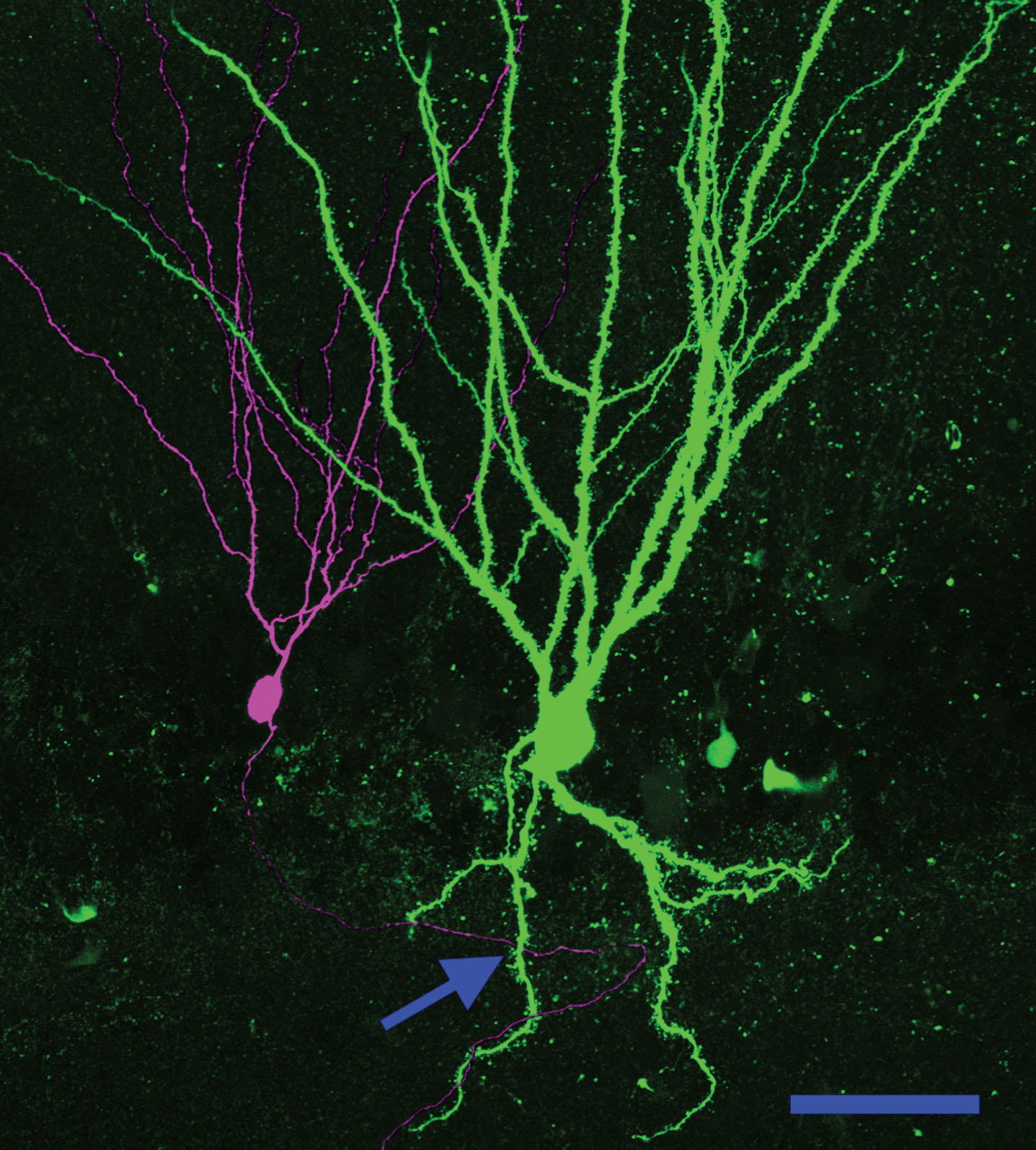 Basal dendrites create a new pathway for recurrent excitatory contacts in the epileptic dentate gyrus. Neuronal reconstruction shows a biocytin-filled PTEN KO cell (green) and a biocytin-filled PTEN-expressing (purple) cell from a PTEN KO (Gli1-CreERT2, PTENfl/fl) mouse. The KO cell exhibits a large basal dendrite. The arrow denotes a point where the axon of the wildtype cell occupies the same focal plane in the z-axis as the PTEN KO cell basal dendrite, suggesting that a synaptic contact could be formed. Scale bar = 50μm.