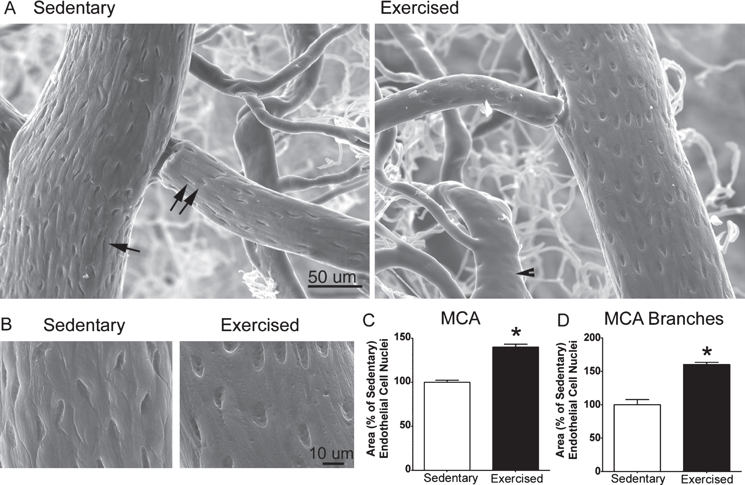 Scanning electron micrographs comparing cerebrovascular microstructure of sedentary and exercised middle-aged mice. A) Low magnification images of the middle cerebral artery (MCA) (single arrow) with branch (double arrow) in a sedentary (left) and exercised (right) mouse. Arteries are distinguished from veins (arrowhead) by the distinct impressions made by their endothelial cell nuclei (ECN). B) High magnification images of ECN imprints from the MCA in a sedentary (left) and exercised (right) mouse. C and D) Exercise increased the area of ECN in the MCA and its associated branches. *p < 0.005, t-test. Adapted with permission from Latimer, et al. [128].