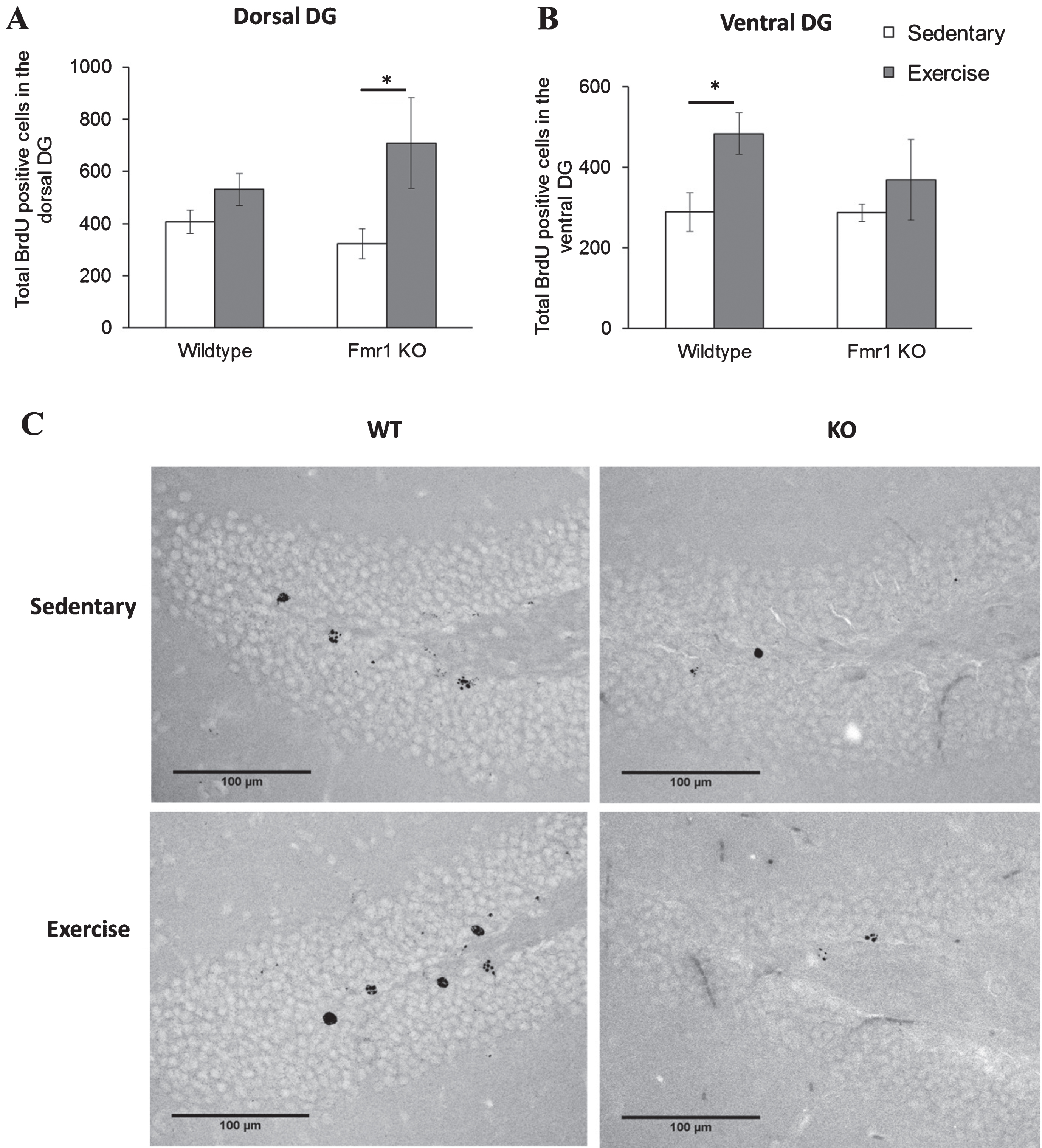 Chronic exercise modifies cell survival rate in FMR1 KO mice. (A) The number of BrdU-positive neurons in dorsal hippocampal dentate gyrus significantly increased after long term running paradigm in FMR1 KO mice. (B) In the ventral dentate gyrus, running did not modify cell survival in the FMR1 KO mice, while in WT animals there was a significant increase in BrdU-positive cells (*p < 0.05). (C) Representative images of BrdU-positive cells in the hippocampal dentate gyrus. Scale bar: 100μm.