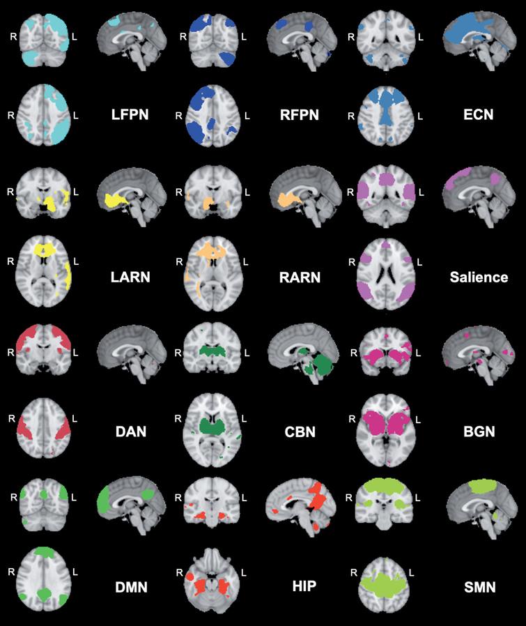 Networks derived from group ICA decomposition. The colored network maps are presented at a threshold of Z > 2.3 based on the group ICA. BGN = Basal Ganglia Network; ECN = Executive Control Network; CBN = Cerebellar Network; DAN = Dorsal Attention Network; DMN = Default Mode Network; HIP = Hippocampal Network; LARN = Left Affective and Reward Network; LFPN = Left Fronto Parietal Network; RARN = Right Affective and Reward Network; RFPN = Right Fronto Parietal Network; SMN = Sensorimotor Network; R = right; L = left.