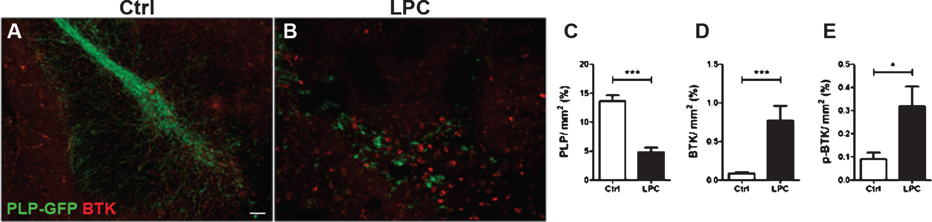 Increased BTK signal upon demyelination. Cerebellar organotypic slices from P9 Plp-GFP mouse (green oligodendrocytes and myelin) were maintained in culture (A) or subjected to LPC treatment at 6 days in vitro (DIV) for 16–17 h (B) before being immunostained for BTK (red) or p-BTK at DIV9. LPC treatment induced a demyelination (loss of GFP signal B, C) and a concomitant 8.5-fold increase in BTK signal (B, D). Similarly, p-BTK was also increased after LPC demyelination (E). (*p < 0.01; ***p < 0.0001). Scale bar = 100 μm.