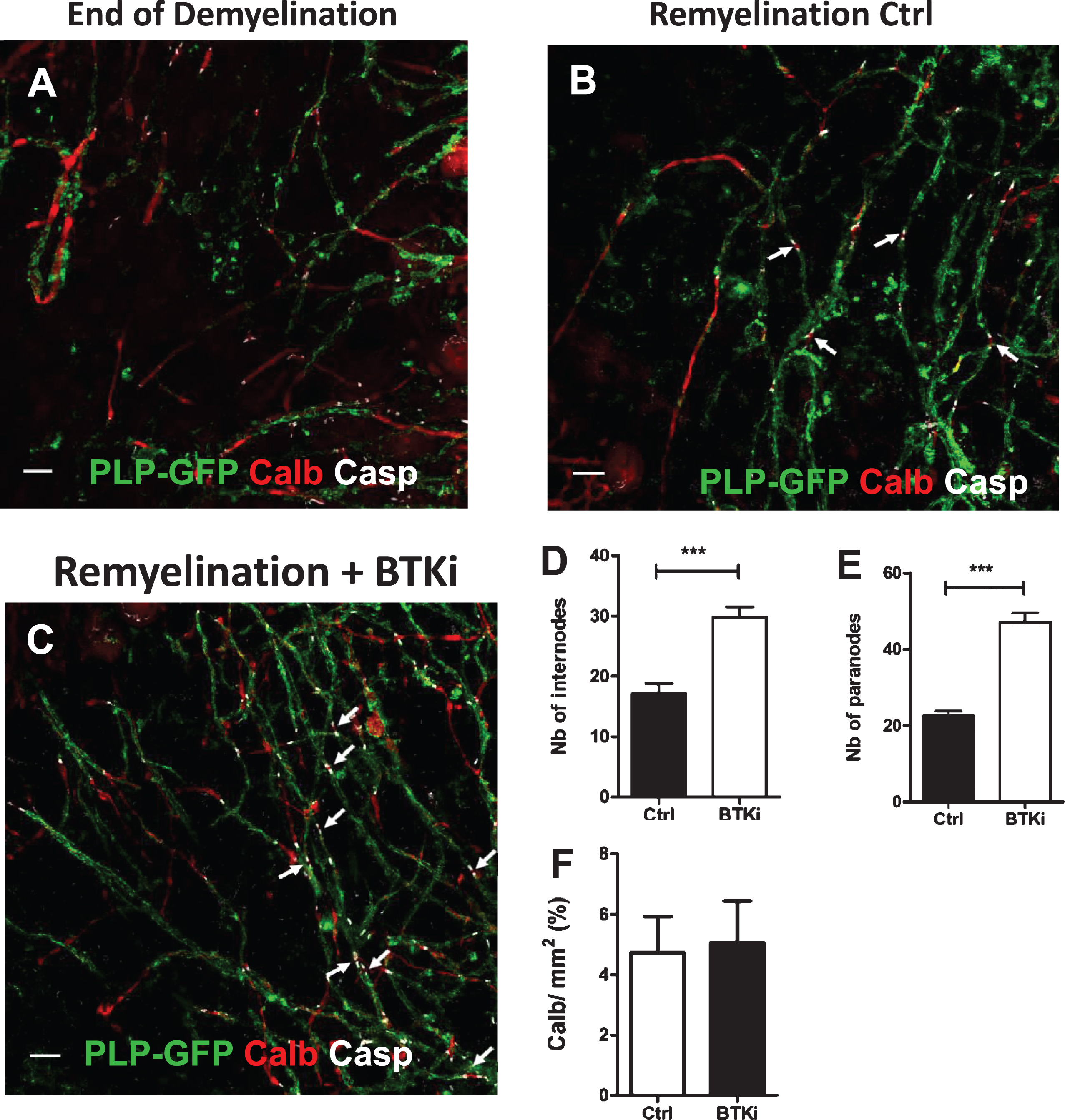 Inhibition of BTK favors remyelination. A–C: Cerebellar organotypic slices from P9 mouse, were exposed to LPC at DIV6 for 16–17 h. At DIV 9, i.e., peak of demyelination, myelinated internodes were no longer observed and only PLP + myelin debris were detected A). At the end of LPC-induced demyelination, cultures were treated with BTKi (BTKi-1) (1 μM) from DIV 9 before triple labeling with anti-PLP (myelinated internodes, green), anti-Caspr (paranodes, white) and anti-Calbindin (axons, red) antibodies. Small white arrows in control (Remyelinated-Ctrl B) and BTKi treated (Remyelinated-BTKi C) cultures point to some complete nodal structures with the Caspr+ paranode on each side of the Calbindin+ naked axon. D–F: Remyelination was evaluated by counting either PLP+ myelinated internodes (D) or Caspr+ paranodal structures (E) and axonal density as measured by the intensity of Calbindin labeling (F) (see M & M section for details). Scale bar = 10 μm