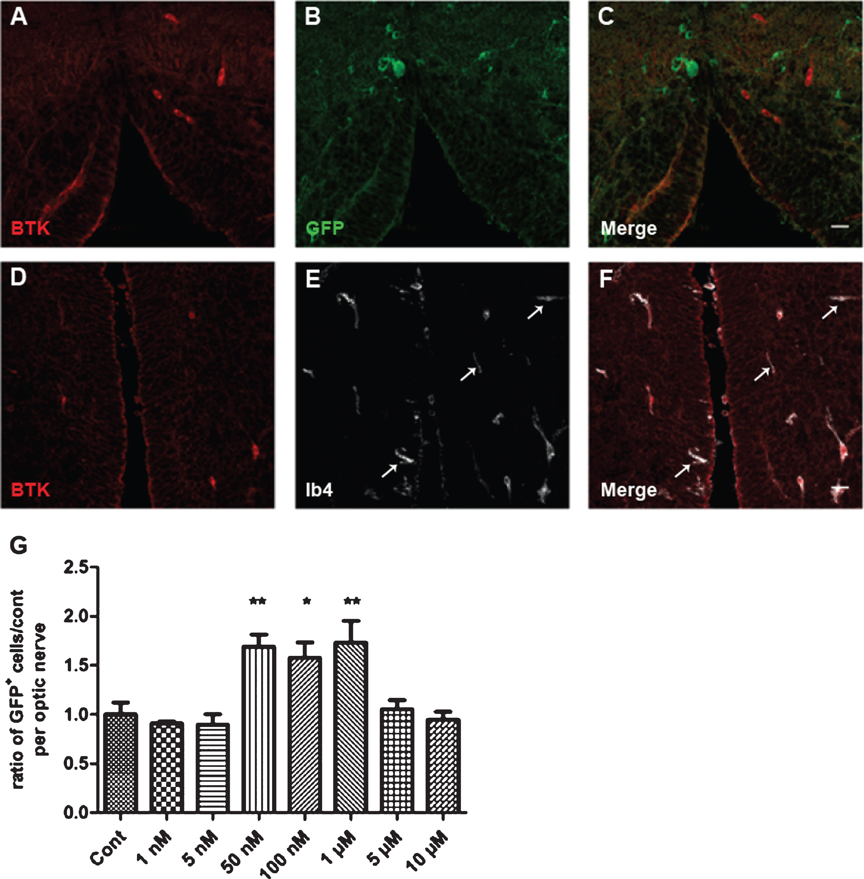 Cellular expression of BTK in Xenopus and dose–response of remyelination by BTKi (BTKi-1). A–F: Immunodetection of BTK in microglial cells, but not in oligodendrocytes. Coronal (A–C) or horizontal (D–F) tissue sections across the brain stem of stage 52–53 MBP-GFP-NTR tadpoles double-labeled with anti-BTK (A, C, D, F, red) and anti-GFP (B, C, oligodendrocytes, green) antibodies or isolectin IB4 (E, F, microglia, white). Note in A–C the complete exclusion of the two labels, illustrating absence of BTK in oligodendrocytes. (D–F) In contrast, all BTK+ cells were also IB4+. However, some IB4+ cells (white arrows) were not BTK+. G: Demyelination of stage 52–53 MBP-GFP-NTR tadpoles was achieved by 10 days exposure to metronidazole (10 mM) in the swimming water. Tadpoles were then returned to normal water or water containing increasing concentration of BTKi (BTKi-1) for 3 days. Remyelination was assayed by counting the number of GFP+ cells per optic nerve on day 3 of the repair period. Treatment of tadpoles with BTKi (BTKi-1) at concentrations ranging between 50 nM and 1 μM improved remyelination up to 1.7-foldcompared to spontaneous recovery (control) set as 1. (*p < 0.01; **p < 0.001). Scale bar in A–F = 20 μm.