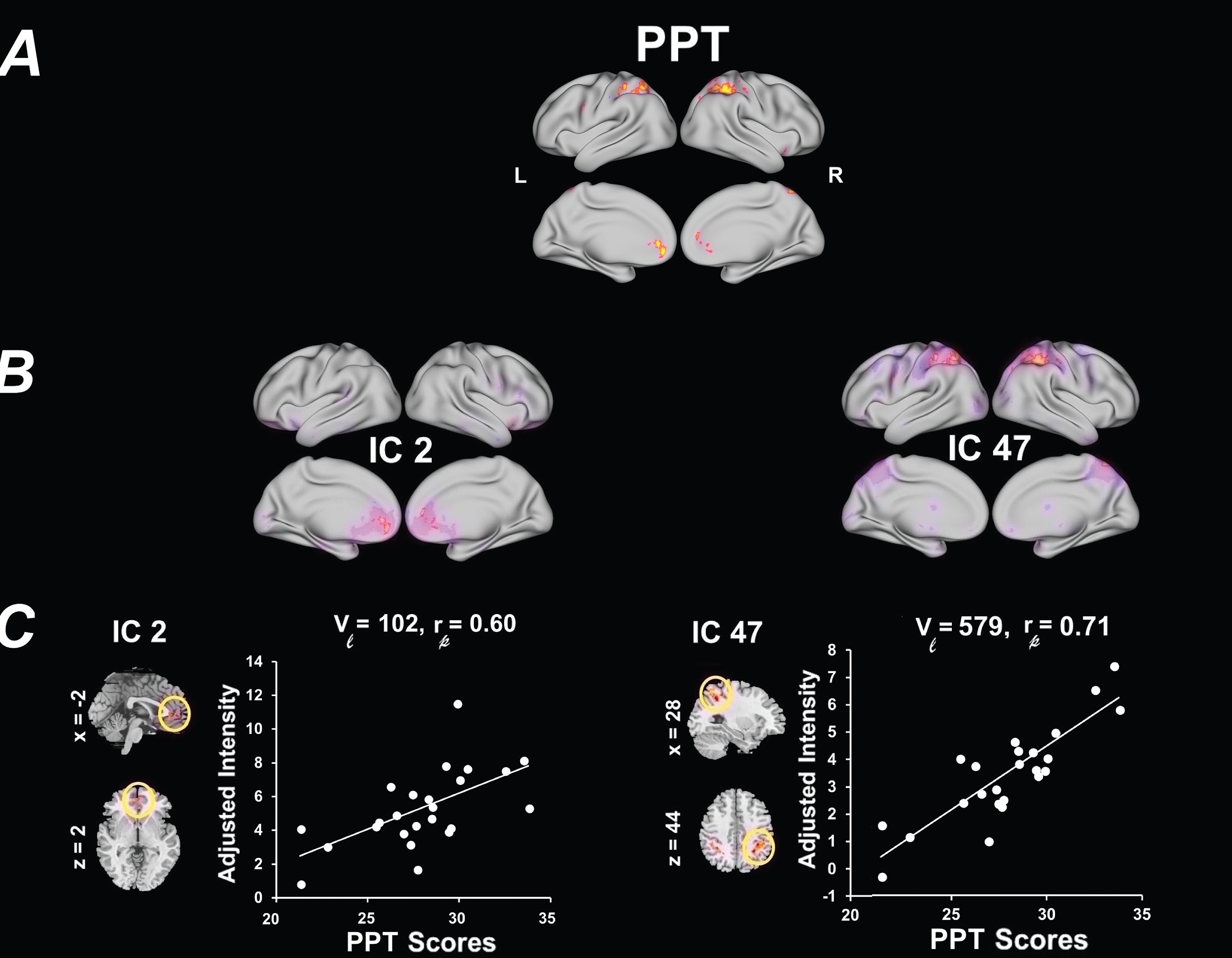 Univariate results summarizing the effects of PPT on RSN spatial map intensities. (A) 3D brain map depicting the composite renderings of significant effects of PPT over all RSNs are displayed as the –sign(t)log10(p) (p < 0.05, uncorrected). (B) Significant effects of PPT are shown in individual RSNs overlaid on their corresponding RSN template (purple) and displayed as the –sign(t)log10(p) (p < 0.05, uncorrected). (C) Scatter plots show the PPT effects for the largest significant cluster in each affected RSN (indicated by yellow or blue circles on the RSN maps shown in representative orthogonal slices with corresponding MNI coordinates) with the number of contributing voxels (Vl), and the partial correlation coefficient (rp). See Table 3 for the associated statistics, anatomical extent, the t-value of the maxima, and corresponding MNI coordinates for the largest significant clusters. PPT, Physical Performance Test total scores; SMN, sensorimotor networks; SCN, subcortical networks; DMN, default-mode networks; CAN, cognitive and attention networks; L, left; R, right.