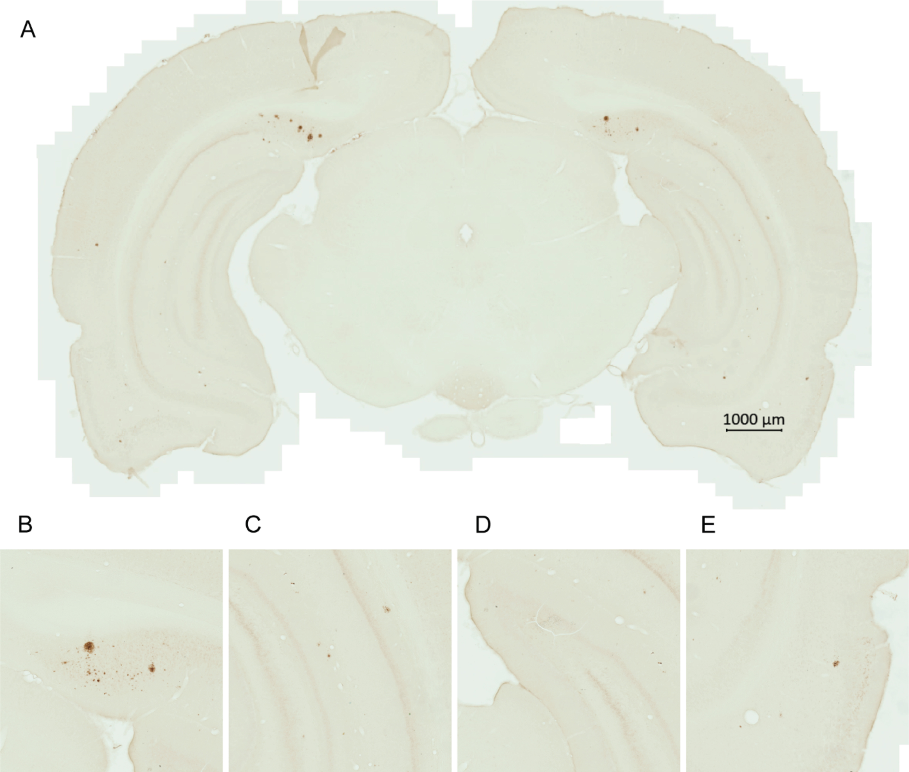 Amyloid plaques in the brain of a transgenic AD rat. A representative image of a brain section from a 6.8-month-old untreated male transgenic AD rat shows early amyloid plaque pathology (A). Majority of the plaques were within the subiculum (B), with less plaques seen in the cornu ammonis (C), dentate gyrus (D), and entorhinal cortex (E).