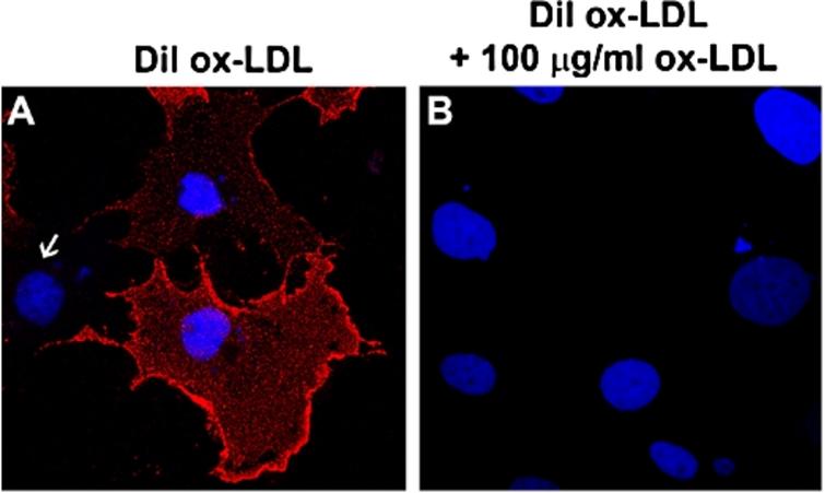Cell-based assay for monitoring LOX-1-ox-LDL interaction. (A) Cells were incubated with 10 µg/ml of DiI-ox-LDL at 4°C for 60 min. Typical membrane fluorescence of DiI-ox-LDL was detectable only in LOX-1 transfected cells. Nuclei are blue stained with Hoechst 33342. White arrow indicates one not-transfected cell. (B) Specific binding of ox-LDL was measured as displaceable binding in the presence of 100 µg/ml of unlabeled ox-LDL.