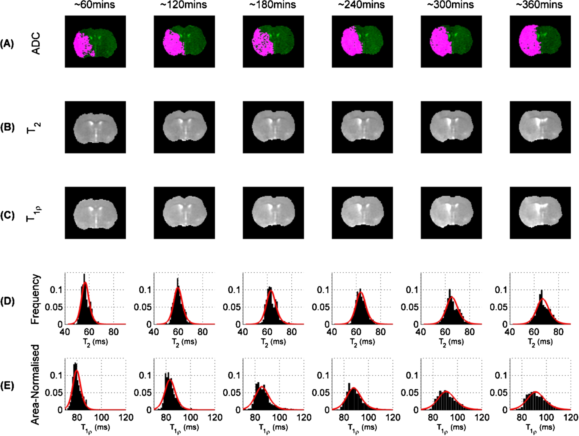 (A) ADC images (green) with lesion masks (pink), (B) T2 and (C) T1ρ maps from a typical rat across multiple time points (separated by approximately 1-hour intervals). (D) Distribution of T2 within ADC lesion and (E) distribution of T1ρ within ADC lesion across multiple time-points.