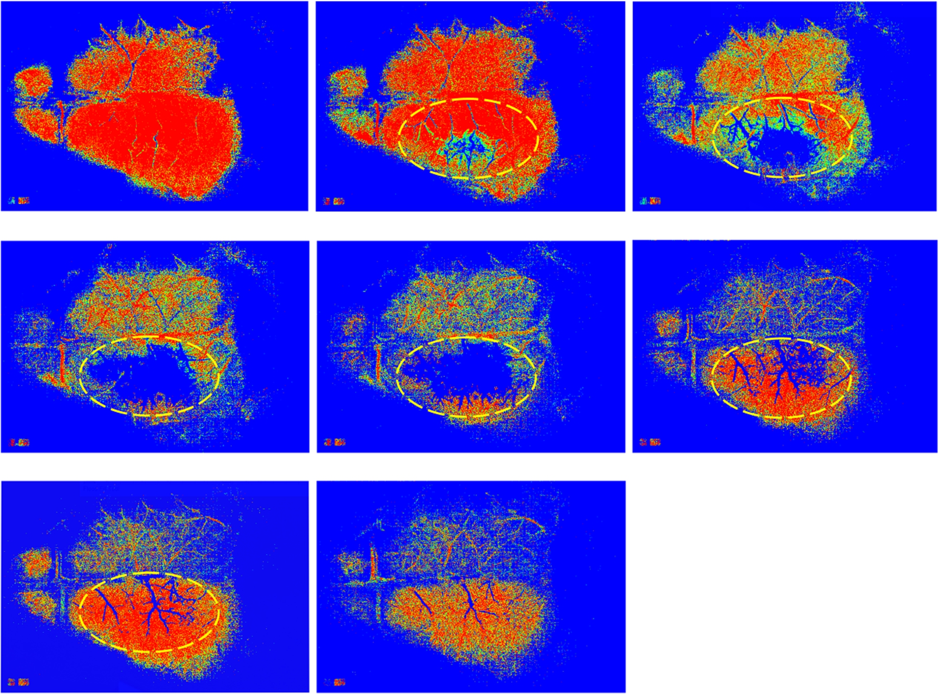 The MHIs showing clearly the areas with low perfusion in the right hemisphere of a mouse brain during induced occlusion of the middle cerebral artery (MCA). Each MHI was generated from a stack of DF images around a particular time point given in Fig. 2. For the computation of each MHI, a buffer of 8 images with a threshold value of 14 was used.