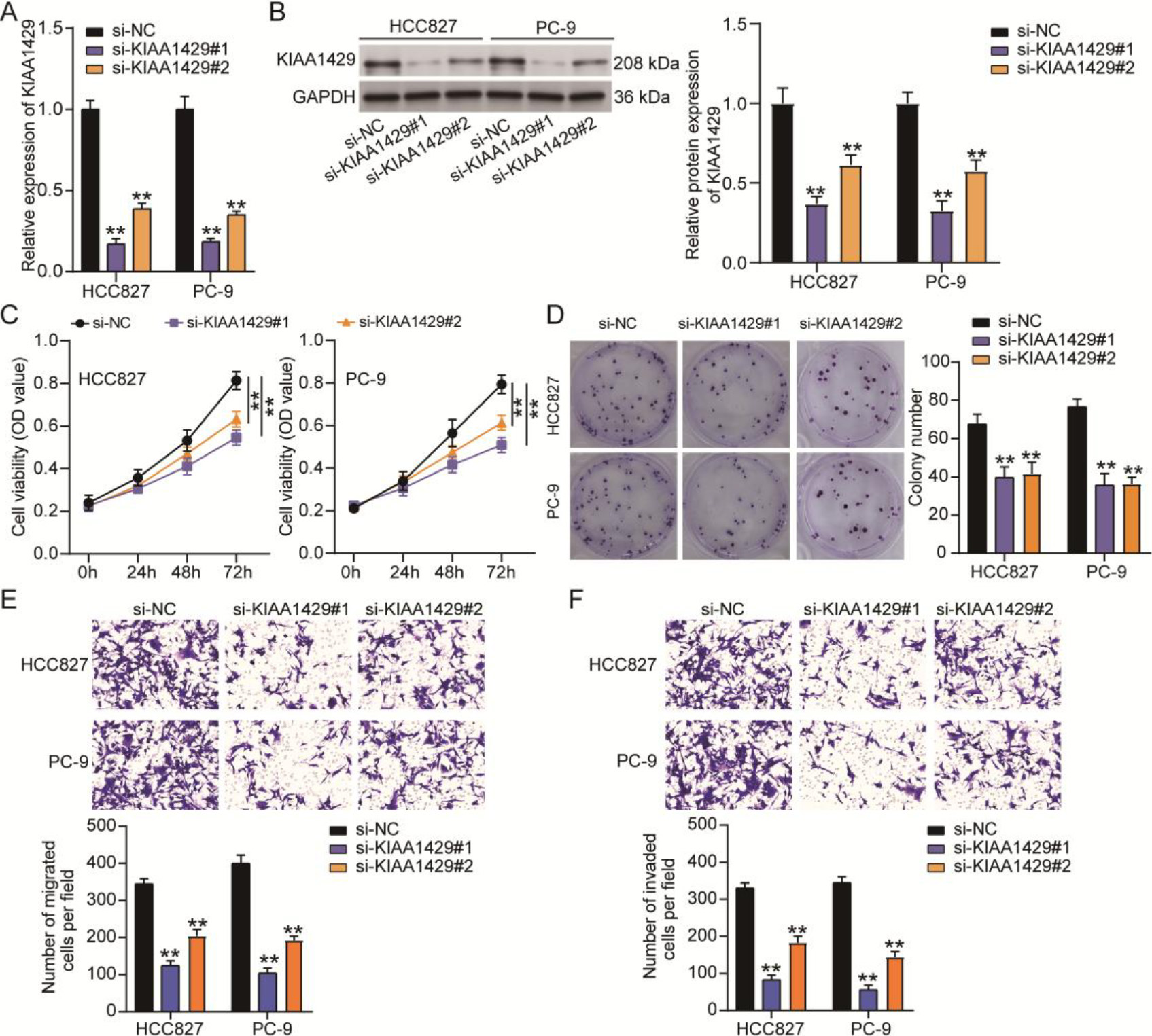 The effect of KIAA1429 knockdown on non-small cell lung cancer (NSCLC) cell malignancy. Quantitative real-time polymerase chain reaction (A) and western blotting (B) confirmed the transfection efficiency of two siRNAs targeting KIAA1429 (si-KIAA1429#1 and si-KIAA1429#2) in NSCLC cells. (C) The cell counting kit-8 assay was used to analyze the effect of KIAA1429 knockdown on NSCLC cell viability. (D) A colony formation assay was used to determine the effect of KIAA1429 knockdown on NSCLC cell proliferation. Transwell migration (E) and invasion (F) assays were used to evaluate the effect of KIAA1429 knockdown on the migration and invasion abilities of NSCLC cells. **P < 0.001 vs. si-NC calculated using the analysis of variance confirmed the significant differences in NSCLC cell function among the si-NC, si-KIAA1429#1, and si-KIAA1429#2 groups. All data is representative of three independent experiments. Error bars represent the standard deviation.