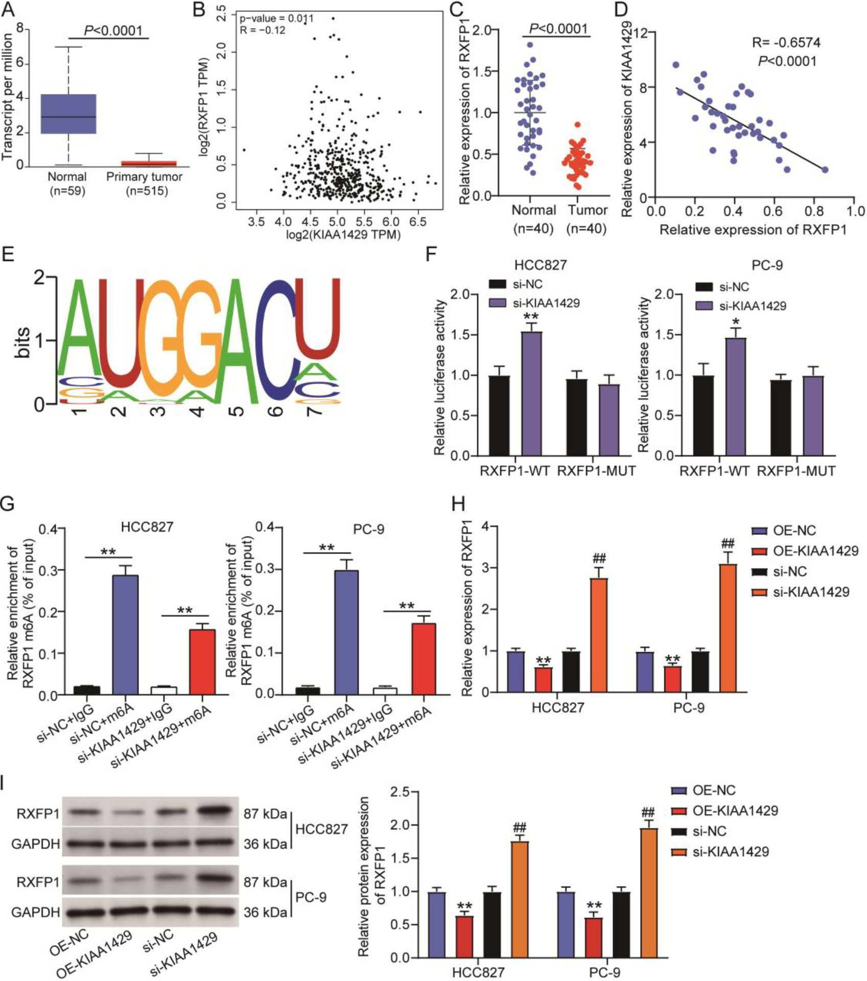 KIAA1429-mediated N6-methyladenosine (m6A) modification of relaxin family peptide receptor 1 (RXFP1) in non-small cell lung cancer (NSCLC) cells. (A) UALCAN was used to analyze RXFP1 expression in TCGA-lung adenocarcinoma samples. (B) GEPIA was used to analyze the correlation between KIAA1429 and RXFP1 expression in TCGA-lung adenocarcinoma samples. (C) Quantitative real-time polymerase chain reaction confirmed RXFP1 expression in 40 NSCLC and paired normal tissues collected in this study. A t-test was used to compare the significant difference in RXFP1 expression between normal and tumor tissues. (D) Pearson’s correlation analysis was used to determine the correlation between RXFP1 and KIAA1429 expression in 40 NSCLC samples. R=-0.6574 and P< 0.0001 indicated a significant negative correlation. (E) The m6A modification site of RXFP1 was predicted using RBMase v2.0. (F) Luciferase activity in NSCLC cells co-transfected with RXFP1-WT/RXFP1-MUT and si-NC/si-KIAA1429 was quantified using a luciferase assay. *P < 0.05, **P < 0.001 vs. RXFP1-WT + si-NC calculated using the analysis of variance confirmed the significant difference in luciferase activities among different groups. (G) MeRIP assay was used to detect the m6A levels of RXFP1 in NSCLC cells transfected with si-KIAA1429. **P < 0.001 calculated using the analysis of variance verified the significant difference in RXFP1 m6A levels among different groups. qRT-PCR (H) and western blotting (I) confirmed the levels of RXFP1 mRNA and protein in NSCLC cells transfected with OE-KIAA1429 or si-KIAA1429. **P < 0.001 vs. OE-NC calculated using a t-test showed the significant difference in RXFP1 expression between the OE-NC and OE-KIAA1429 groups. ##P < 0.001 vs. si-NC calculated using a t-test showed a significant difference in RXFP1 expression between the si-NC and si-KIAA1429 groups. Error bars represent the standard deviation.