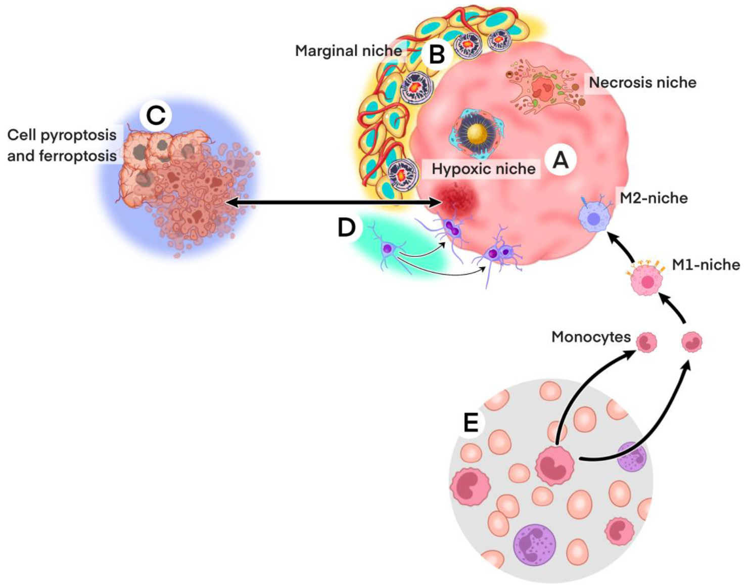 Schematic diagram of GSCs and immune-related mechanisms: A. Tumor entities, including the hypoxic niche and cell necrosis niches caused by tumor cell pyroptosis and ferroptosis and the macrophage niche, involved in adaptive immunity in the tumor microenvironment. B. The jagged and vague tumor periphery mediates tumor cell invasion and dissemination and marginal ecological niches are colonized here. C. Inflammatory necrotic cells located in the tumor necrosis zone caused by pyroptosis and ferroptosis. D. Hippocampus-subependymal neural stem cell niche: Maintenance and expansion of hippocampal- and subventricular-derived neural stem cells follow both symmetric and asymmetric disaggregation patterns to maintain homeostasis of glial-associated downstream cells in normal brain tissue, which in the case of GBM are largely replaced by the associated tumor stem cell niche. At this point, tumor cells may reverse-differentiate into GSCs.