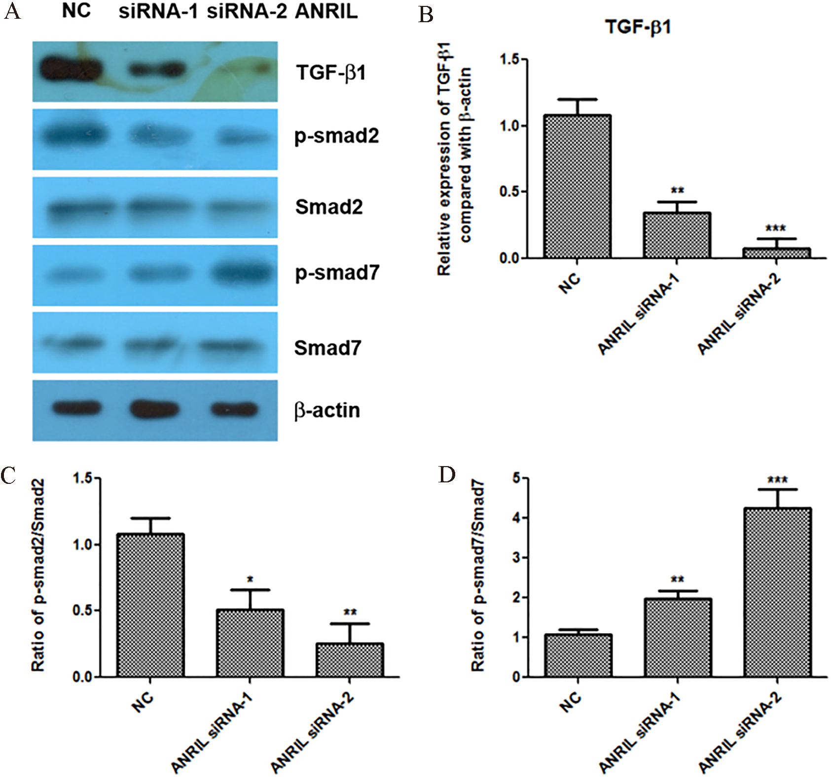 Knockdown of lncRNA ANRIL inactivates the TGF-β1/Smad signaling pathway. A to D. Effect of ANRIL siRNAs on the expression levels of TGF-β1, p-smad2, smad2, p-smad7 and smad7 detected by western blotting assay, and statistical analysis was done using Student’s test. *, P< 0.05; **, P< 0.01; *⁣**, P< 0.001.