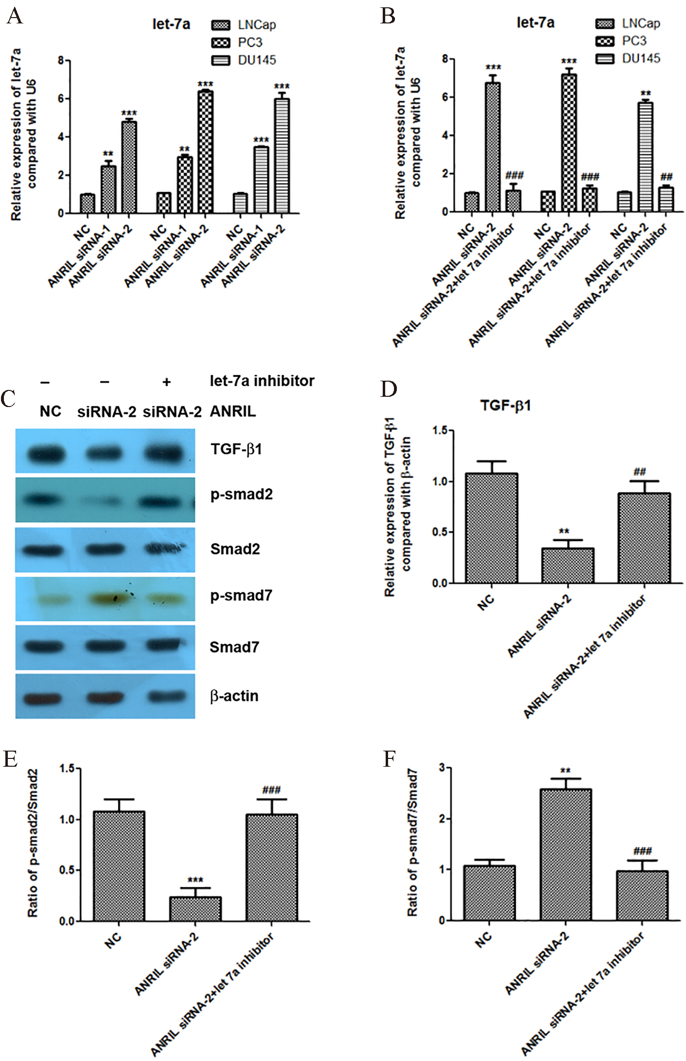 Knockdown of lncRNA ANRIL increases the expression of let-7a, and let-7a inhibitor reactivates the TGF-β1/Smad signaling pathway at the condition of ANRIL silencing. A. Knockdown of lncRNA ANRIL increases the expression of let-7a detected by Real-time PCR. B. Knockdown of let-7a inhibitor in LNCap, PC3 and DU145 cells was detected by Real-time PCR. C to F. Effect of let-7a inhibitor at condition of ANRIL silencing on the expression levels of TGF-β1, p-smad2, smad2, p-smad7 and smad7 detected by western blotting assay, and statistical analysis was done using Student’s test. *, P< 0.05; **, P< 0.01; *⁣**, P< 0.001.