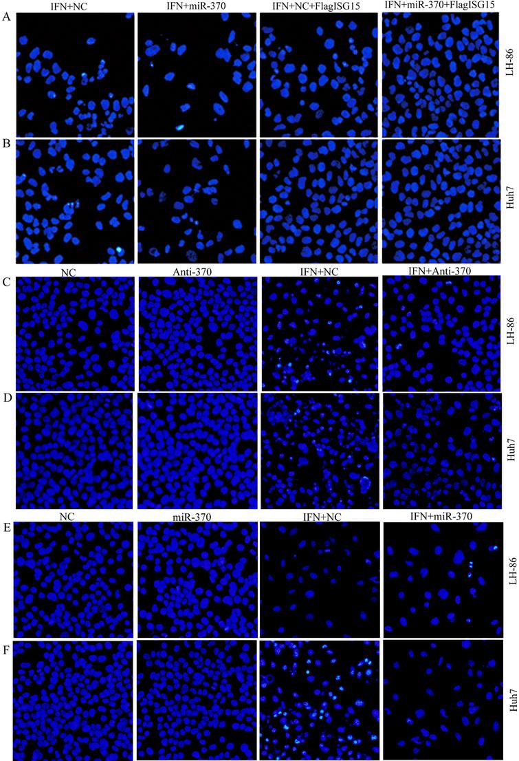 The sensitivity of cancer cells to IFN-α induced apoptosis is modulated through the miR-370 mediated regulation of ISG15 expression. After treatment with IFN-α for 48 h, (A) LH86 and (B) Huh7 cells were transfected with miR-370 and/or pFLAG-ISG15 for 24 h, (C) LH86 cells and (D) Huh7 cells treated with IFN-α for 48 h and/or transfected with anti-miR-370 for 24 h, and (E) LH86 cells and (F) Huh7 cells treated with IFN for 48 h or/and transfected with miR-370 for 24 h. Apoptosis was assessed based on the presence of condensed chromatin and nuclear fragmentation using DAPI staining and fluorescence microscopy. The data presented are representative of 3 independent experiments. 