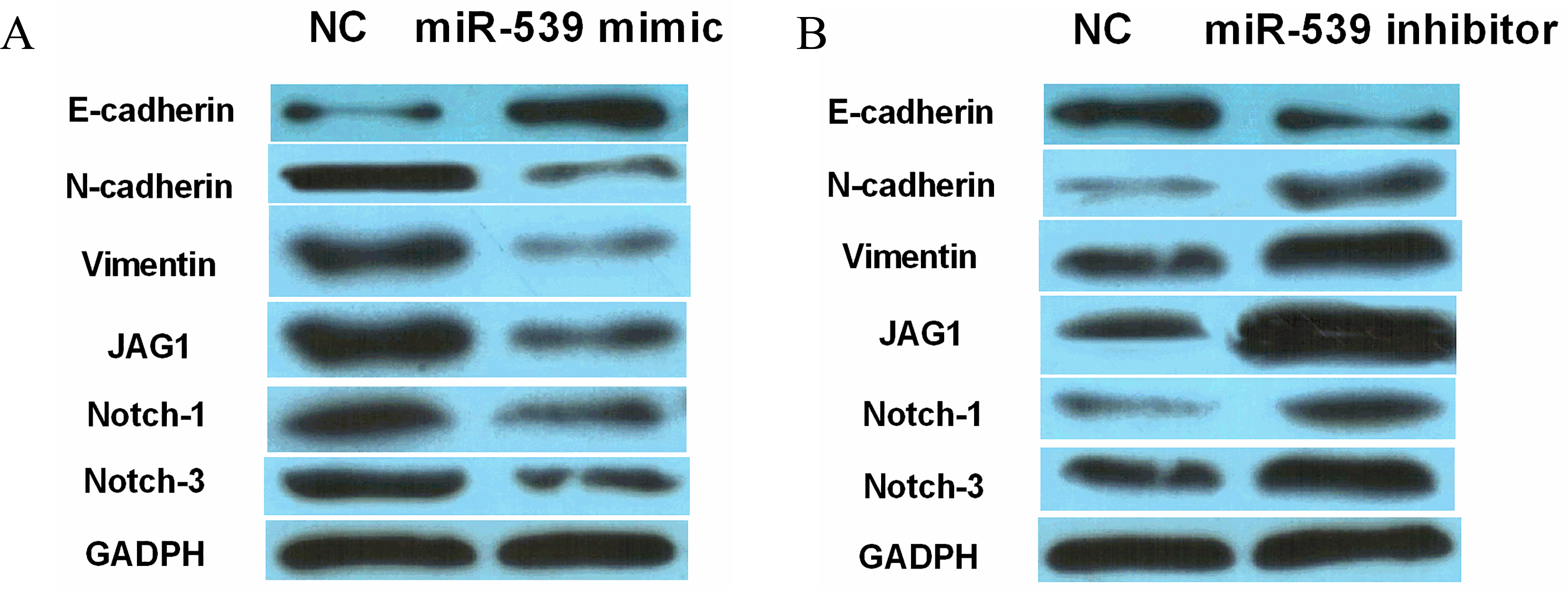 MiR-539 inhibited EMT and Notch1/3 expression in WT. (A, B) The protein expression of E-cadherin, N-cadherin, Vimentin, Notch-1 and Notch-3 in SK-NEP-1 cells contained miR-539 mimics or inhibitor.
