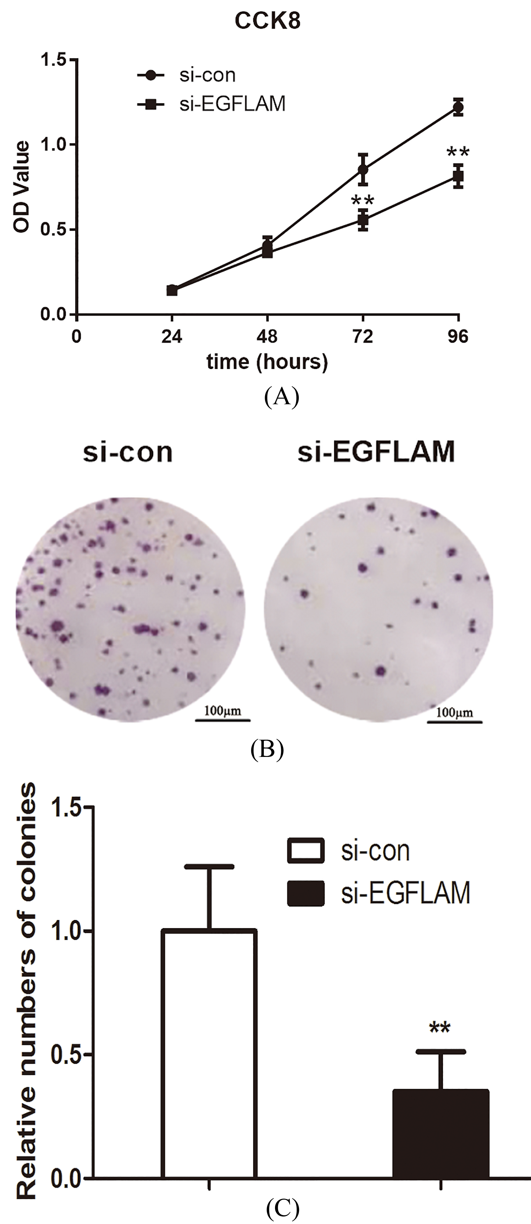 EGFLAM promoted the proliferation of U87 cells. (A) Knockdown of EGFLAM inhibited the viability of U87 cells, which was determined by CCK-8 assays. (B) Knockdown of EGFLAM decreased the colony numbers of U87 cells, which was measured by colony formation assays (Original magnification × 2). si-EGFLAM group represents EGFLAM in U87 cells were silenced, and si-con group represents EGFLAM in U87 cells were not silenced. **p< 0.01 versus si-con group.