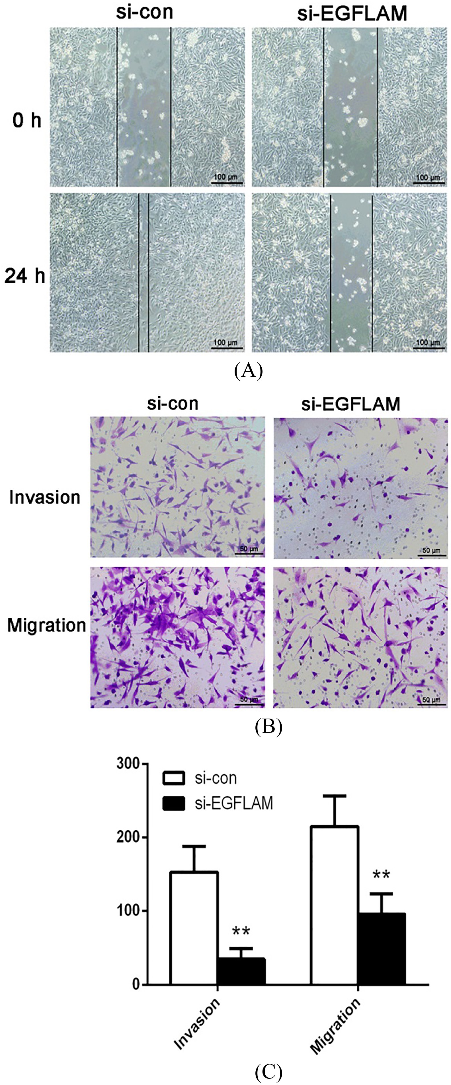 EGFLAM promoted the migration and invasion of U87 cells. (A) Wound healing assay revealed that knockdown of EGFLAM inhibited the migration of U87 cells (Original magnification × 100). (B) Transwell assays showed that knockdown of EGFLAM significantly suppressed the migration and invasion of U87 cells (Original magnification × 200). si-EGFLAM group represents EGFLAM in U87 cells were silenced, and si-con group represents EGFLAM in U87 cells were not silenced. **p< 0.01 versus si-con group.